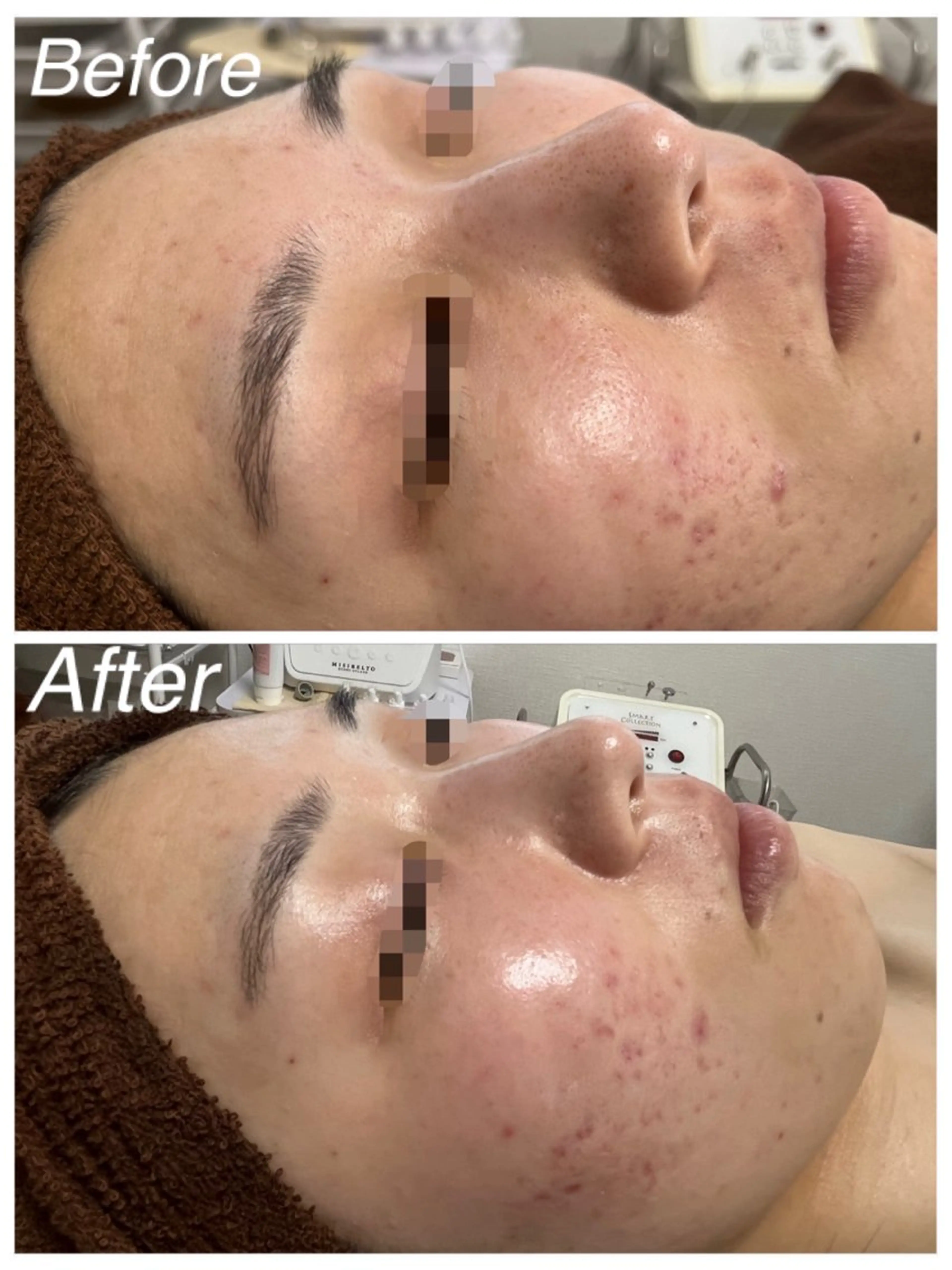 アンシャンテ トータルビューティーのエステ・リラクイメージ