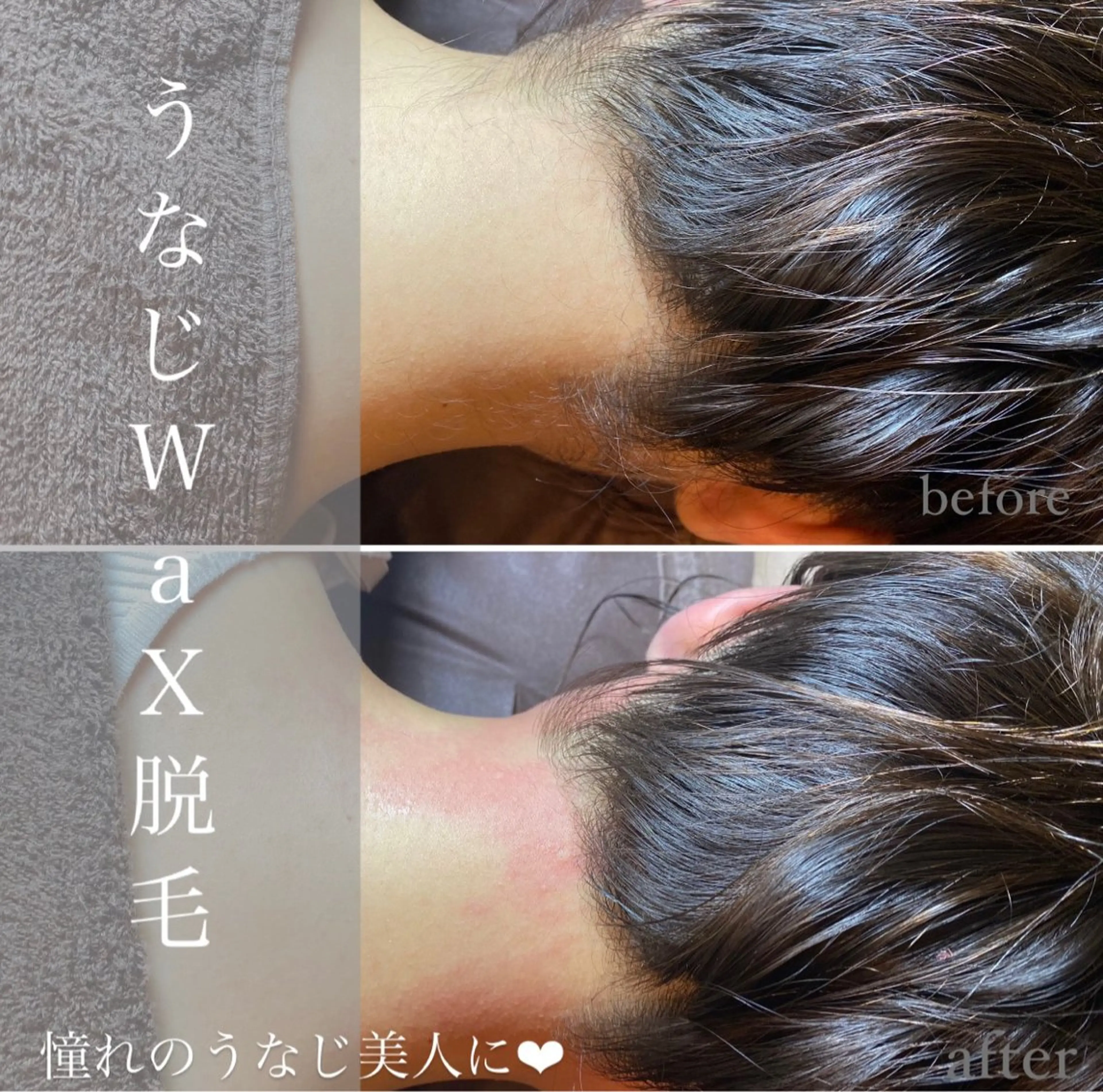 エピナス町田店 ブラジリアンワックスのエステ・リラクイメージ