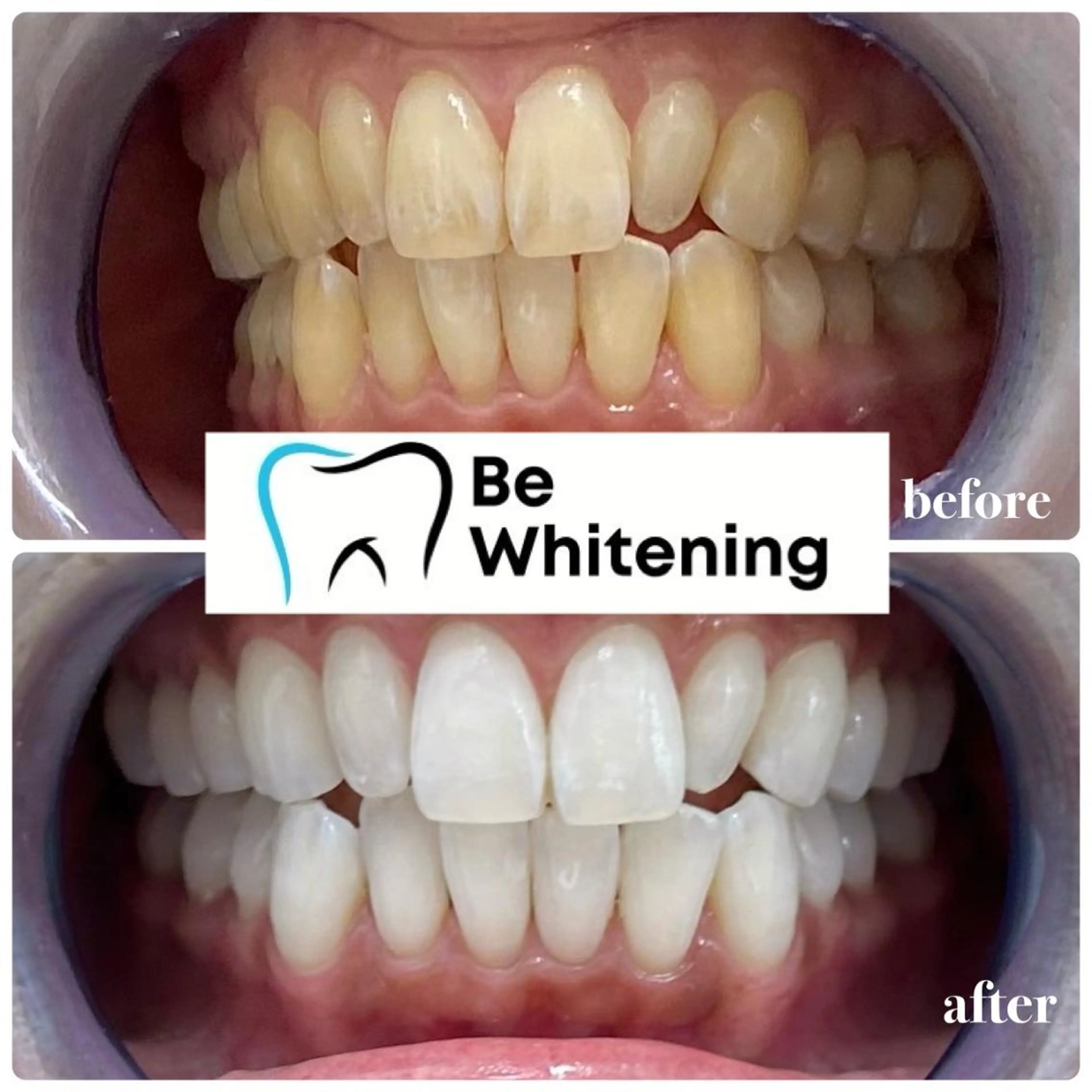 ホワイトニングサロン BE WHITE金山のその他イメージ