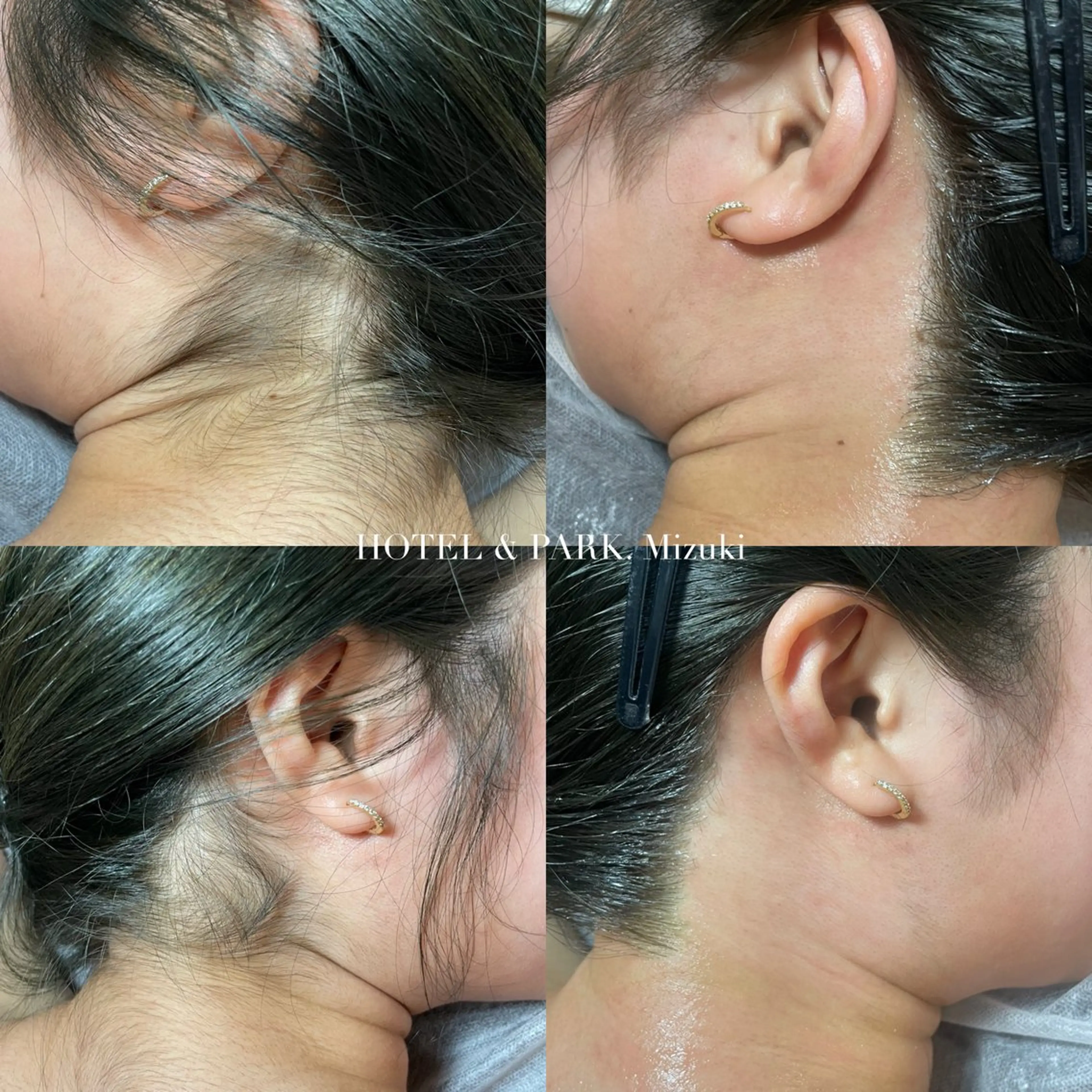 脱毛 HOTEL&PARK . ワックス脱毛のエステ・リラクイメージ