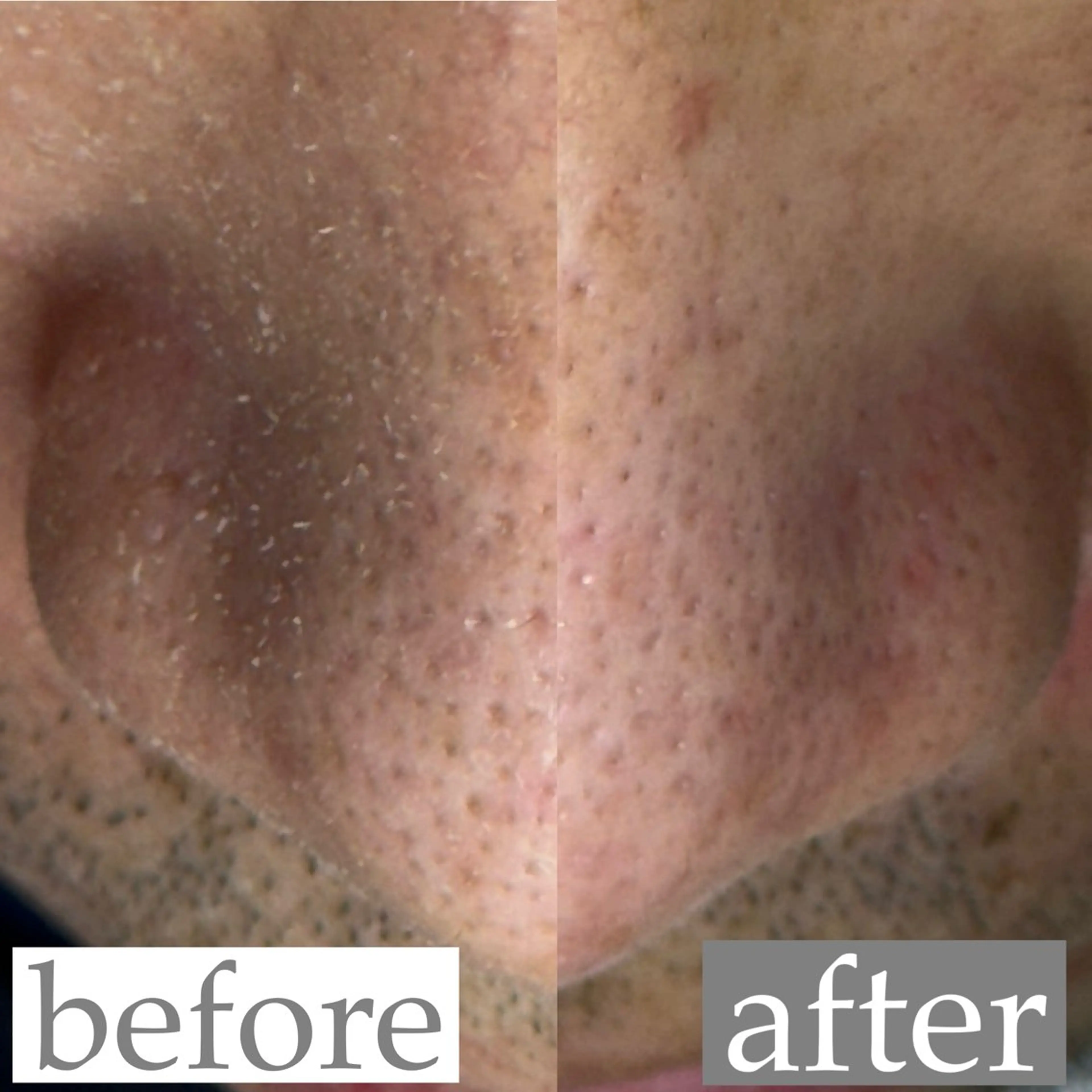 毛穴専門サロン ライカブルーのエステ・リラクイメージ