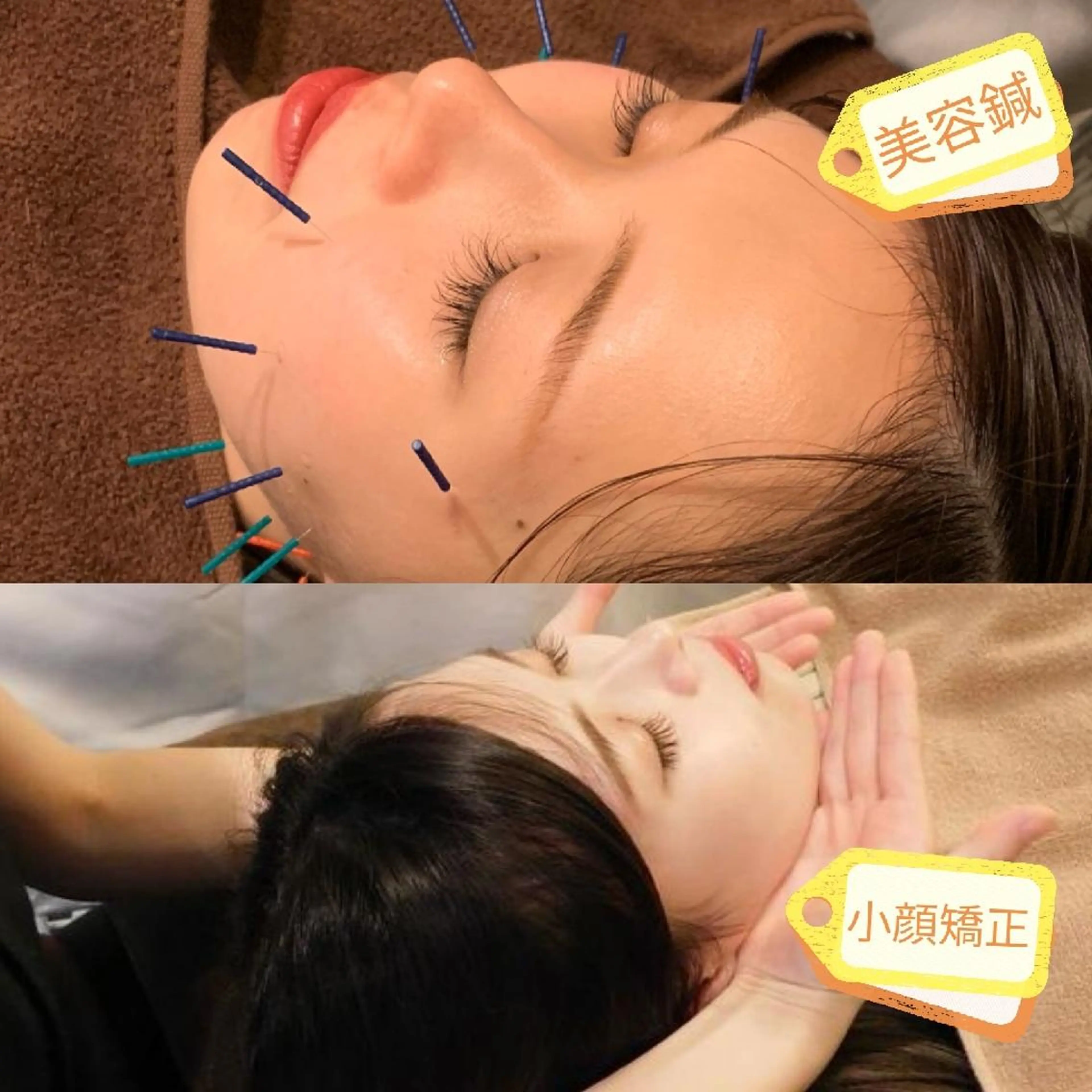 たるみ専門美容鍼 × 猫背整体 のぐち所属・小顔と姿勢改善のプロ ｜整体と美容鍼のぐちのエステ・リラクイメージ