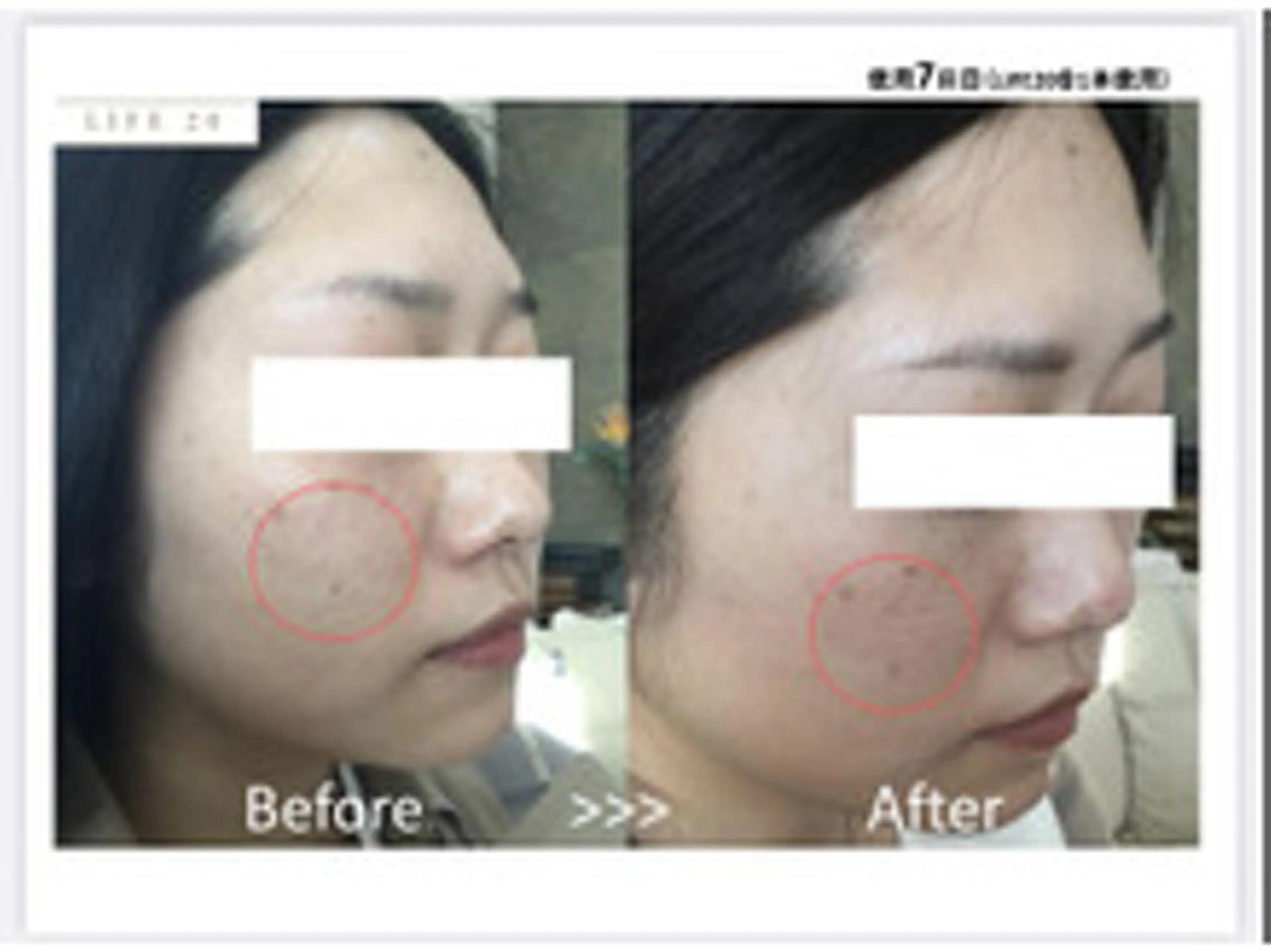 トラブル肌専門店 PLACE梅田堂山店のエステ・リラクイメージ