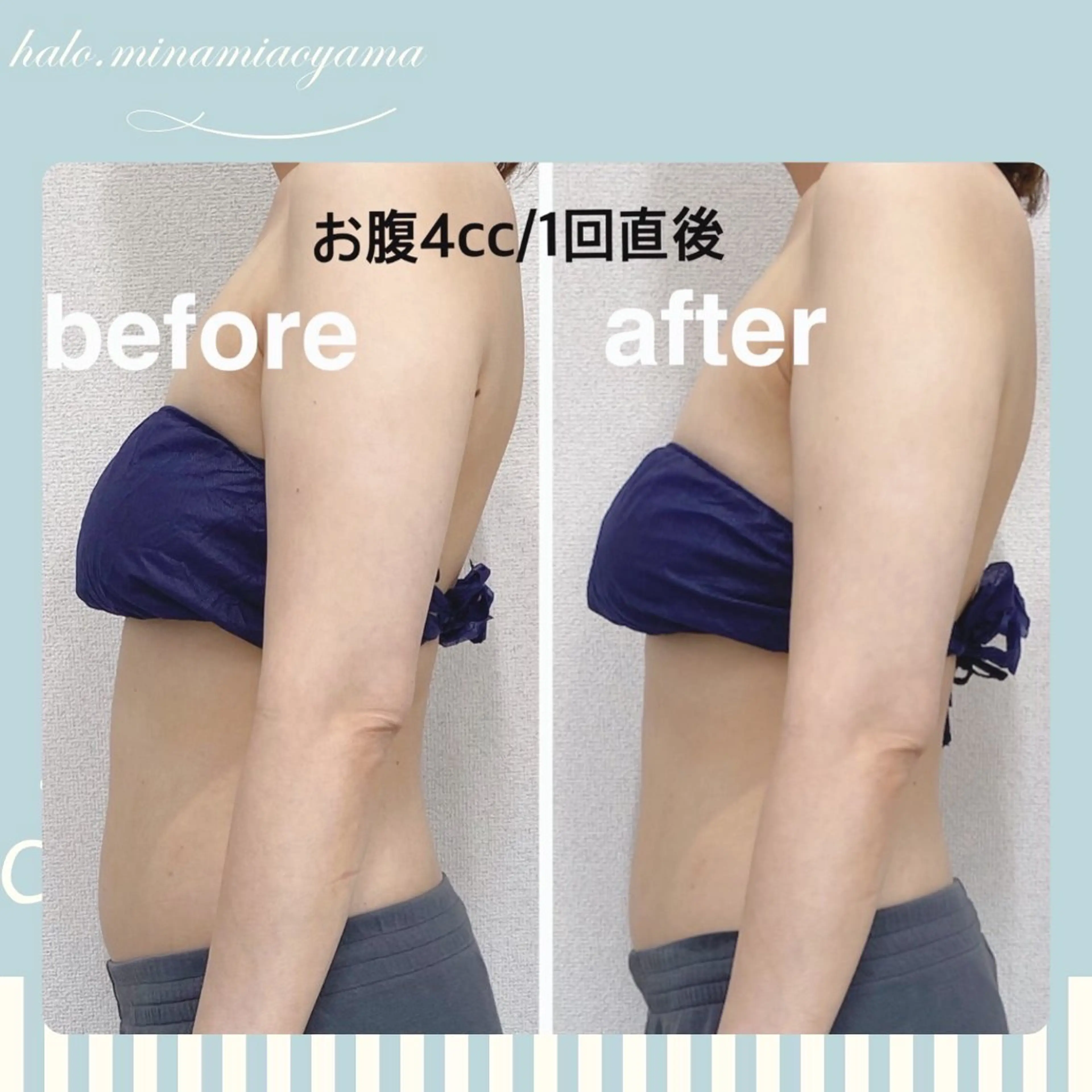 エステ 小顔痩身HALO 二宮早織のエステ・リラクイメージ