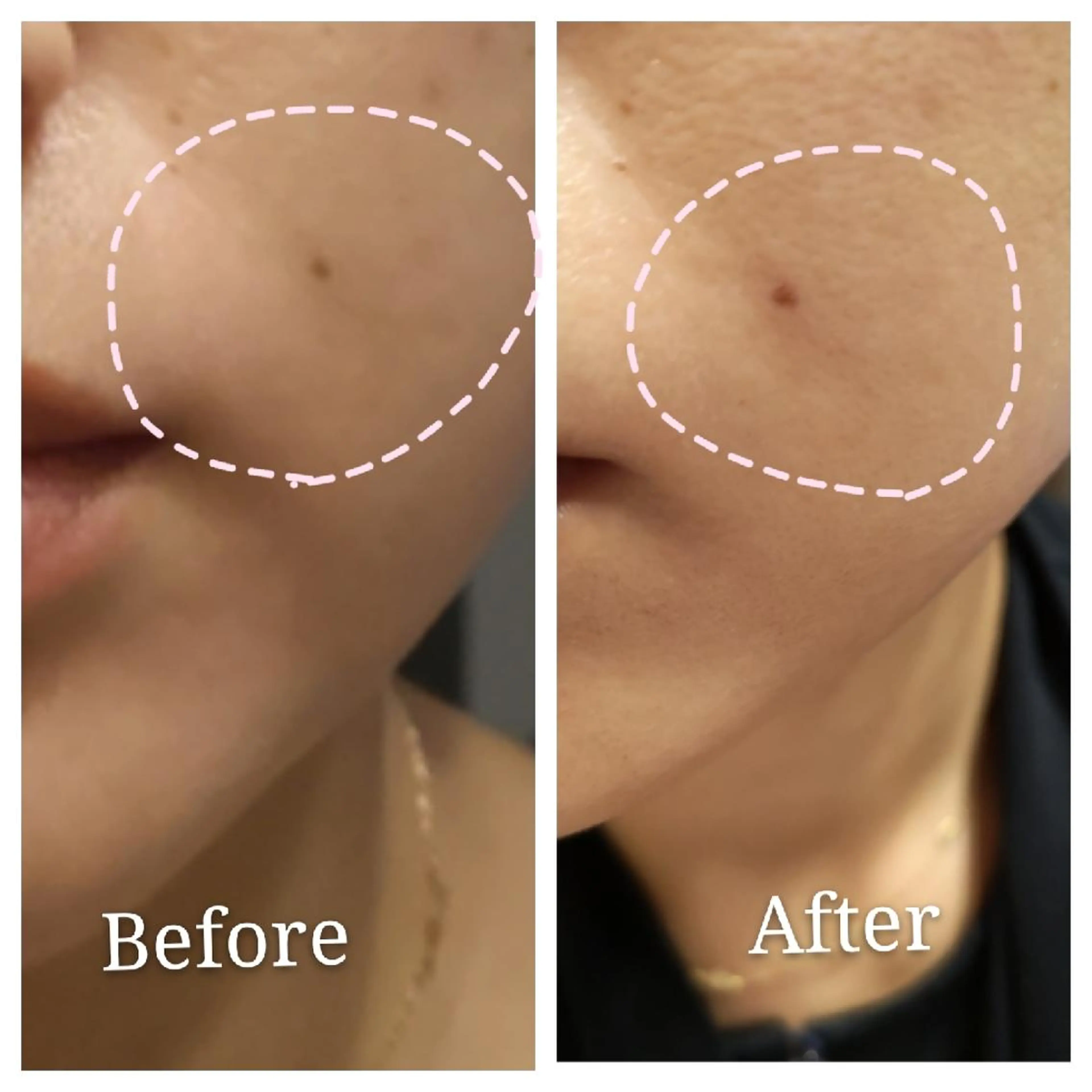 🅖🅤🅩🅔🅛 salonのエステ・リラクイメージ