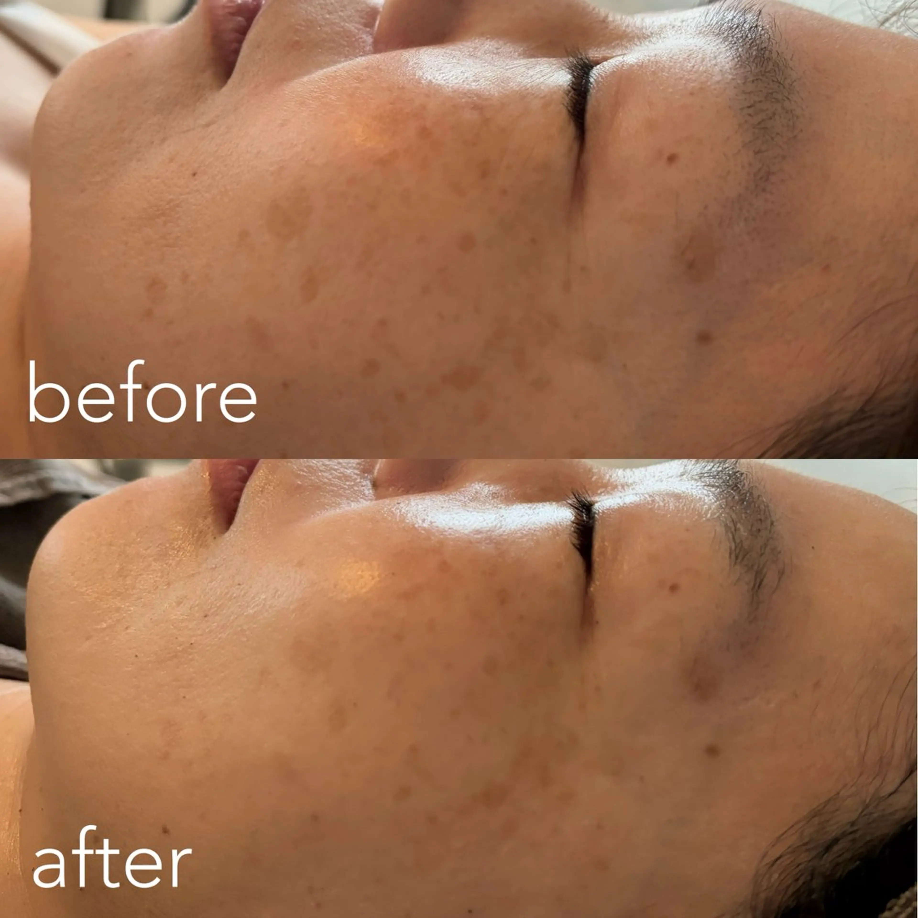 エステティックサロン Liente(リアンテ）所属・Hashimoto .のエステ・リラクイメージ