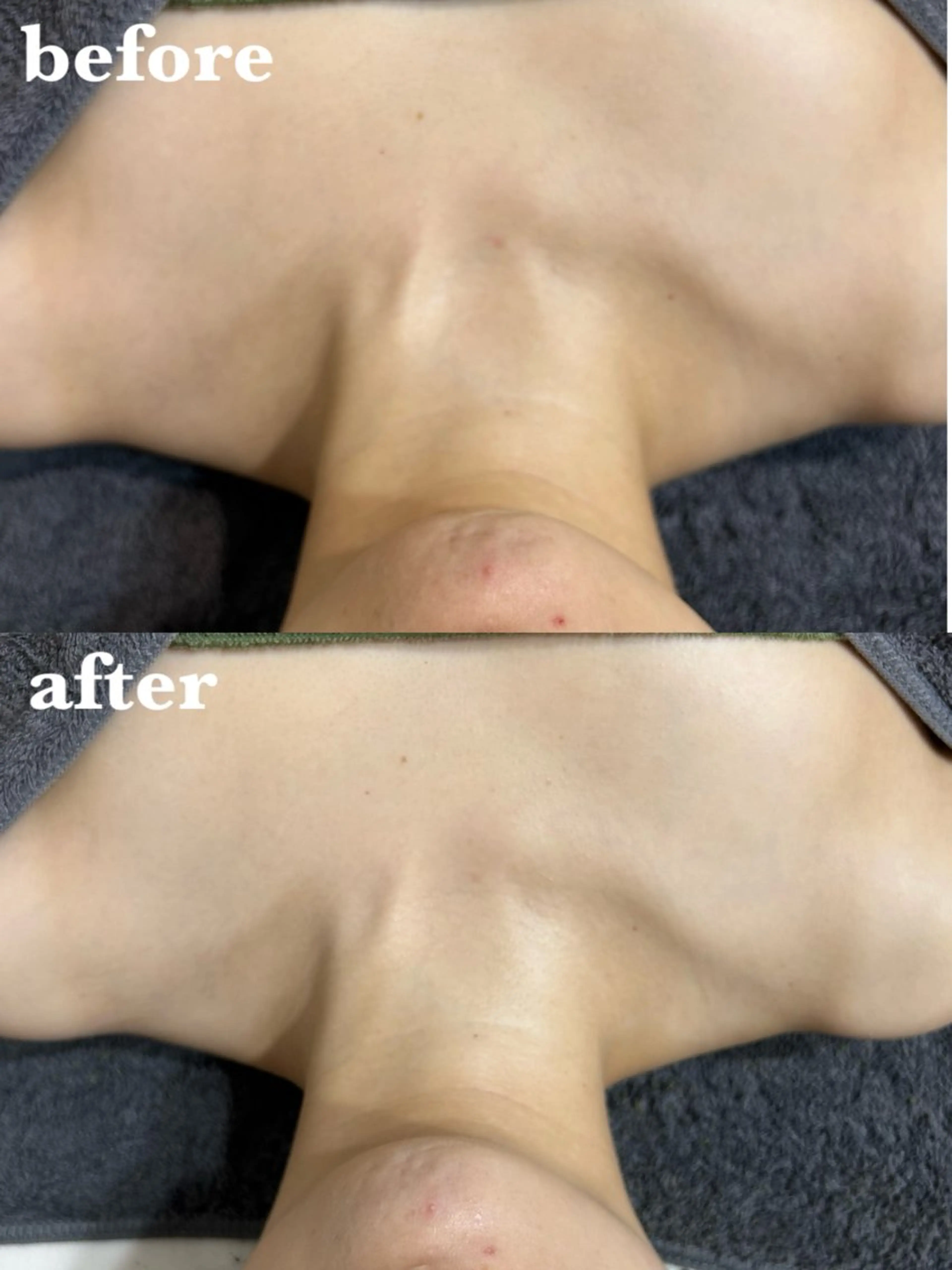 メンズ エステ リラク 【肌質改善サロン】 リーフィアのエステ・リラクイメージ