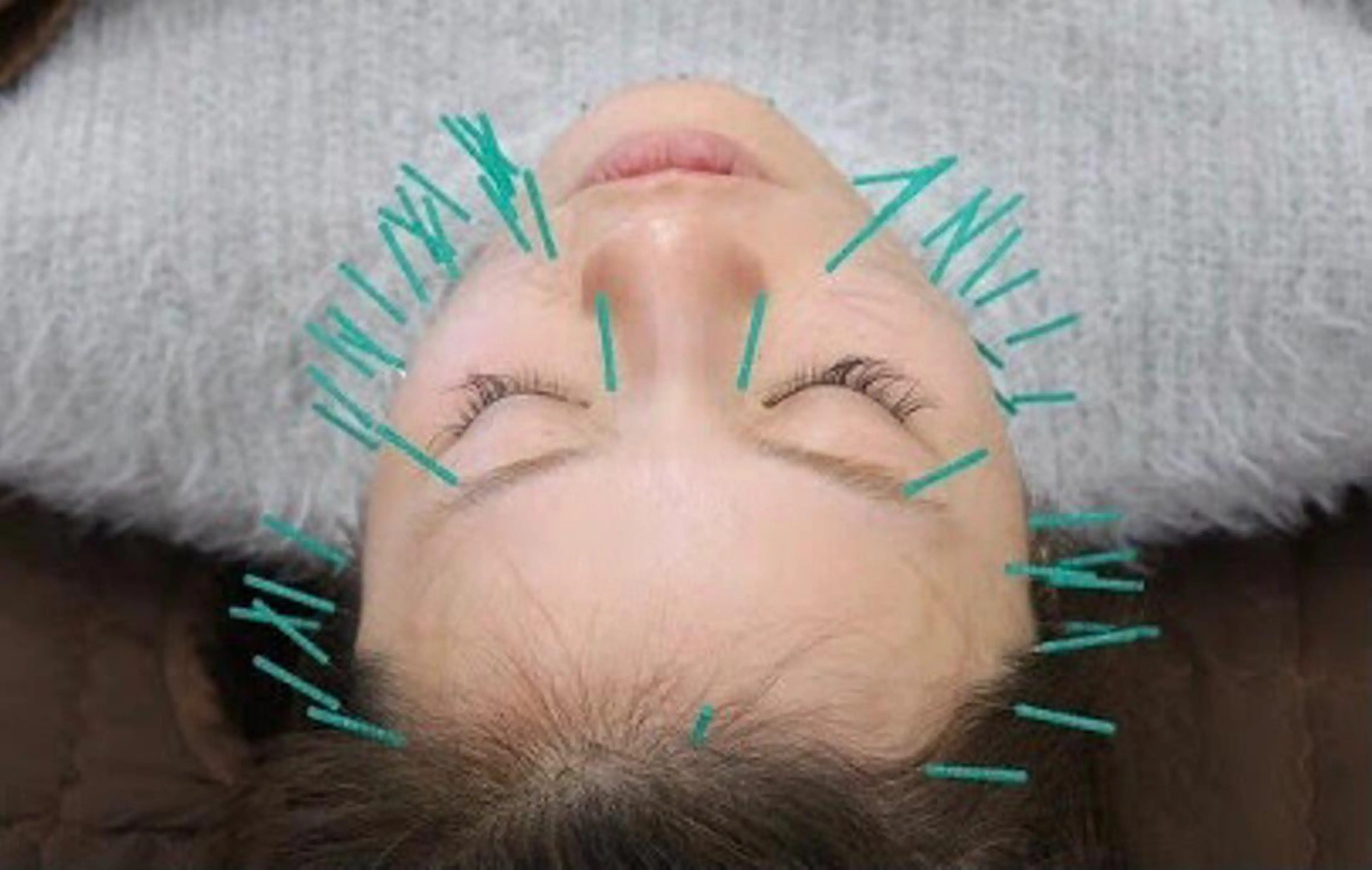 美容鍼サロン    Fleurir所属・伊藤 かなえのエステ・リラクイメージ