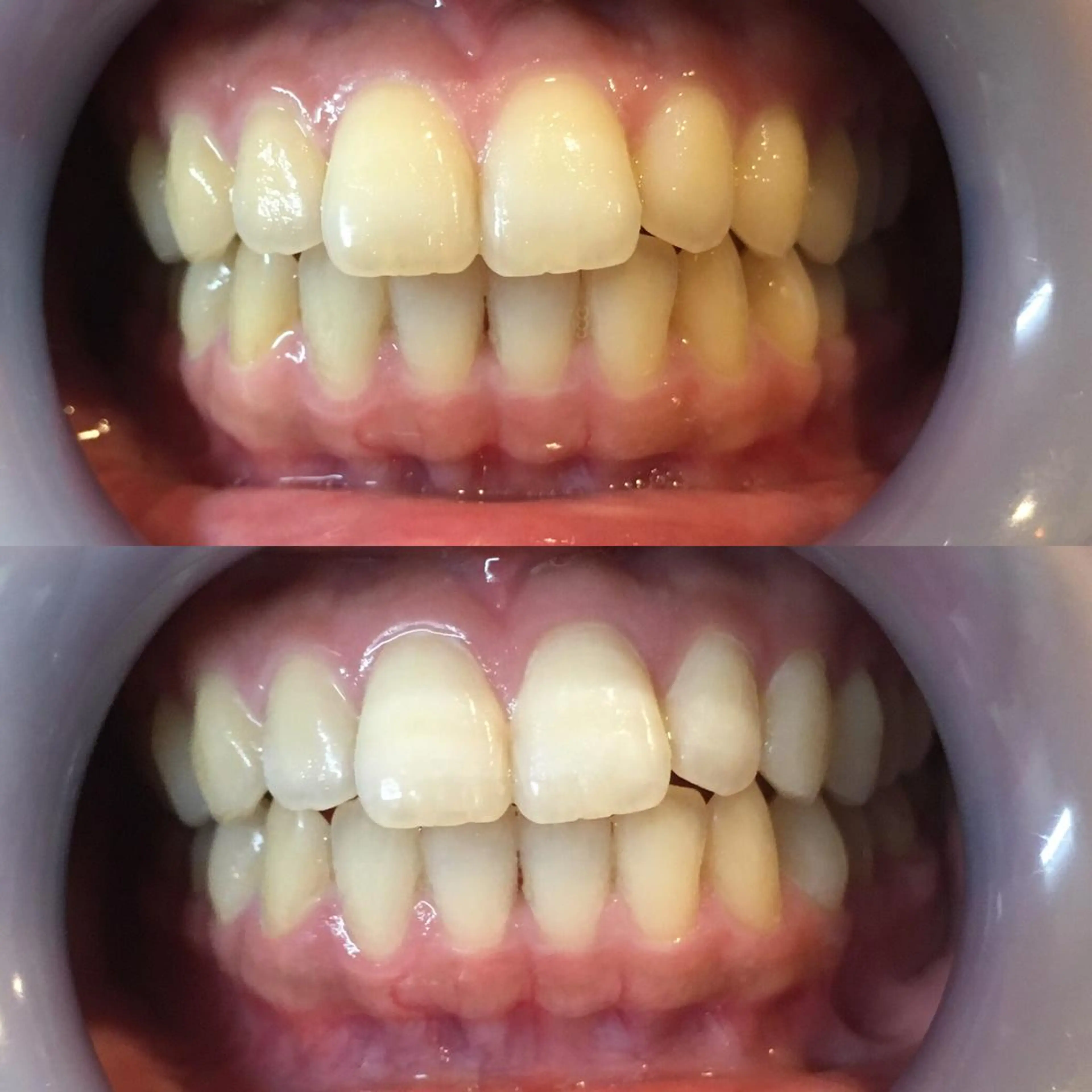 LBSホワイトニング 新宿店💝店長熊倉のその他イメージ