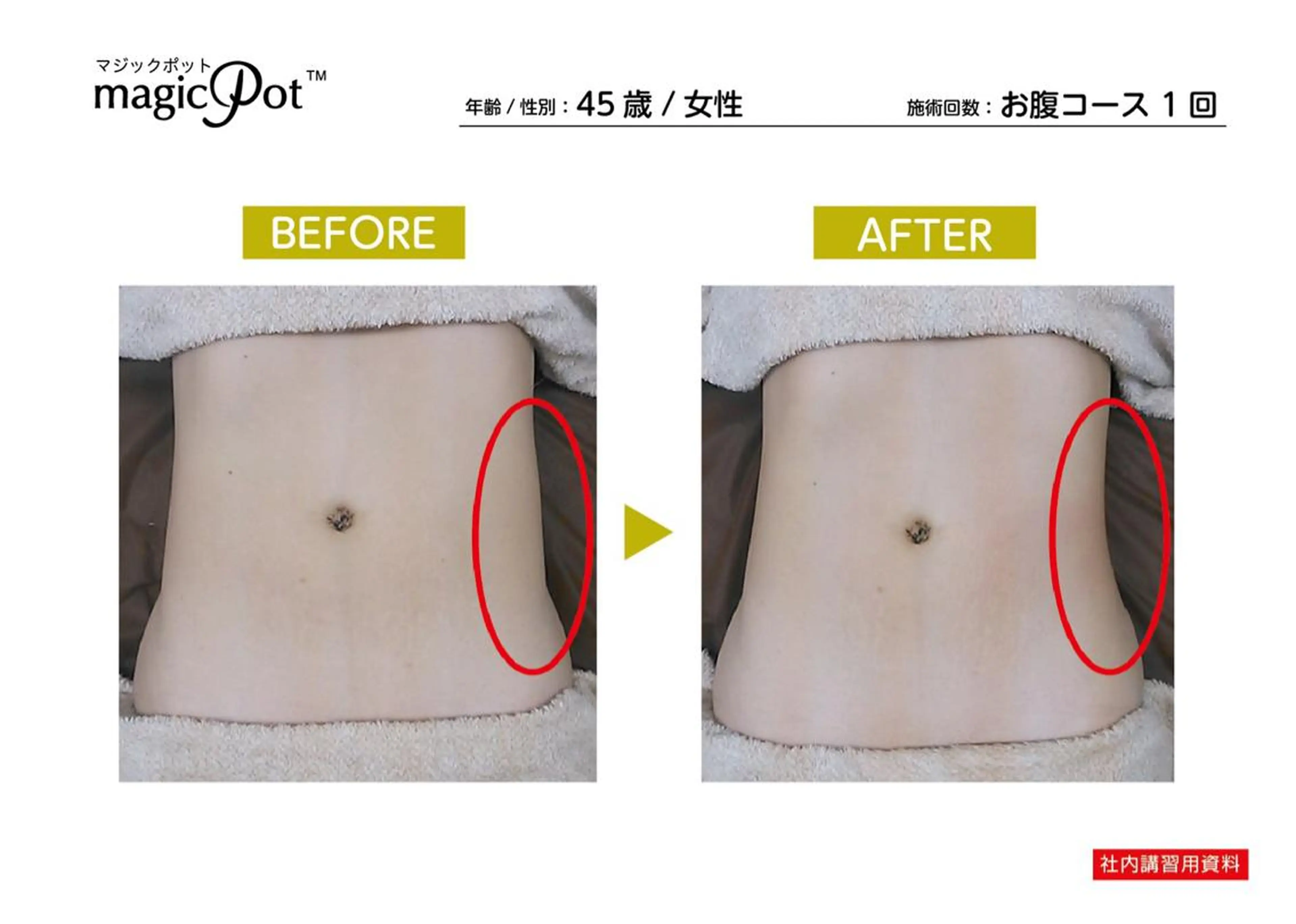 エステ リラク 心斎橋痩身ダイエット 韓国.美容鍼.小顔のエステ・リラクイメージ