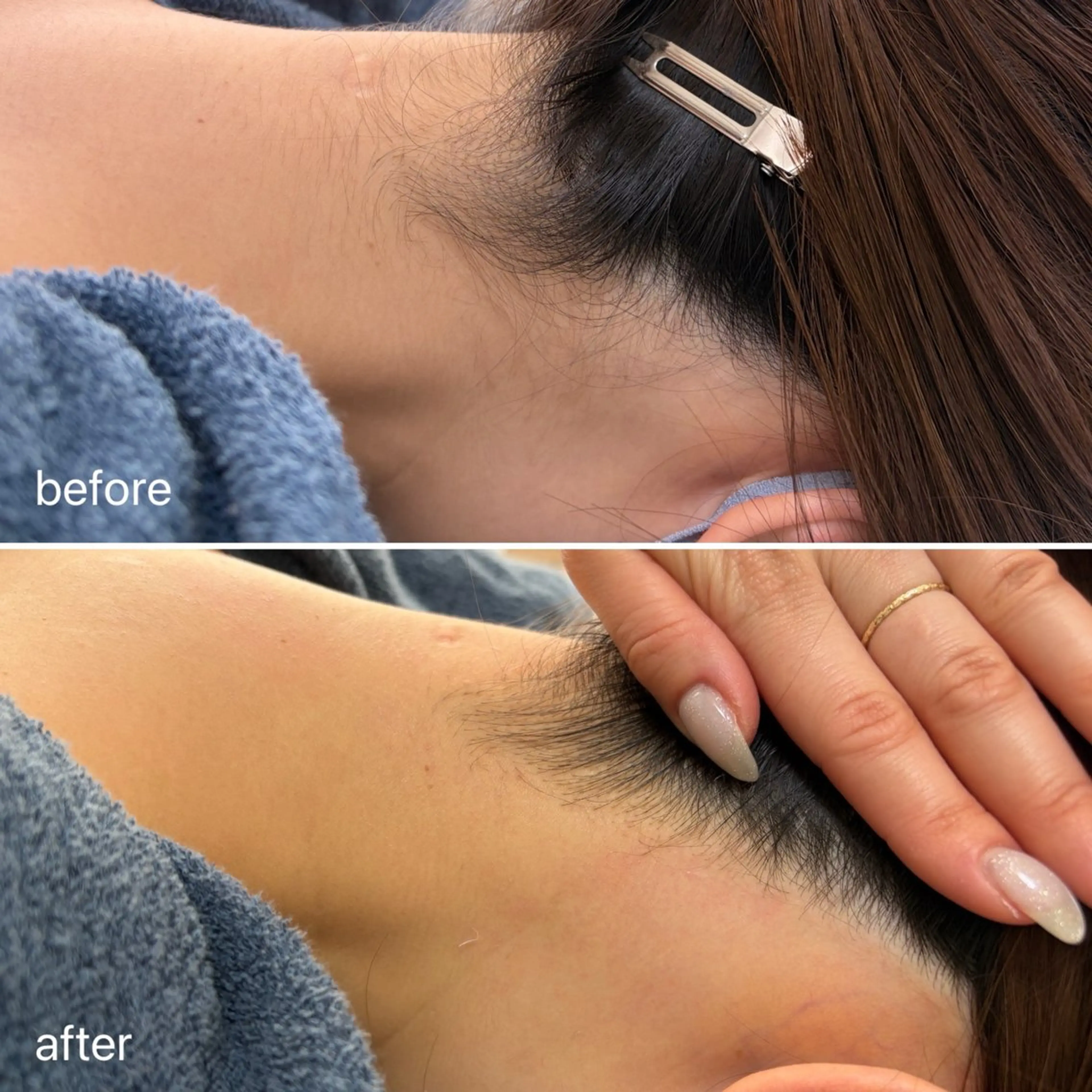 脱毛 小林 未歩のネイルデザイン