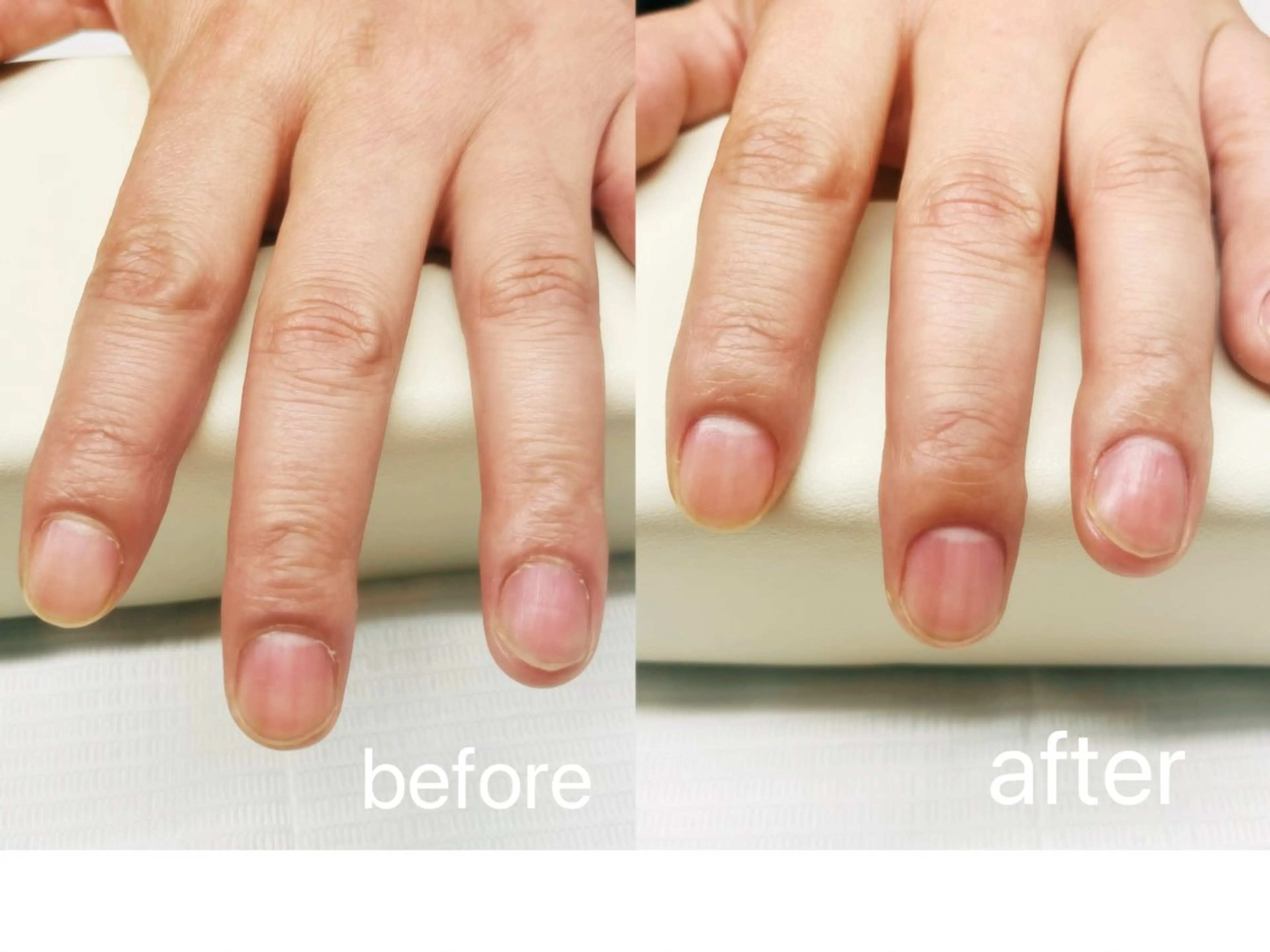 メンズハンドケアの写真