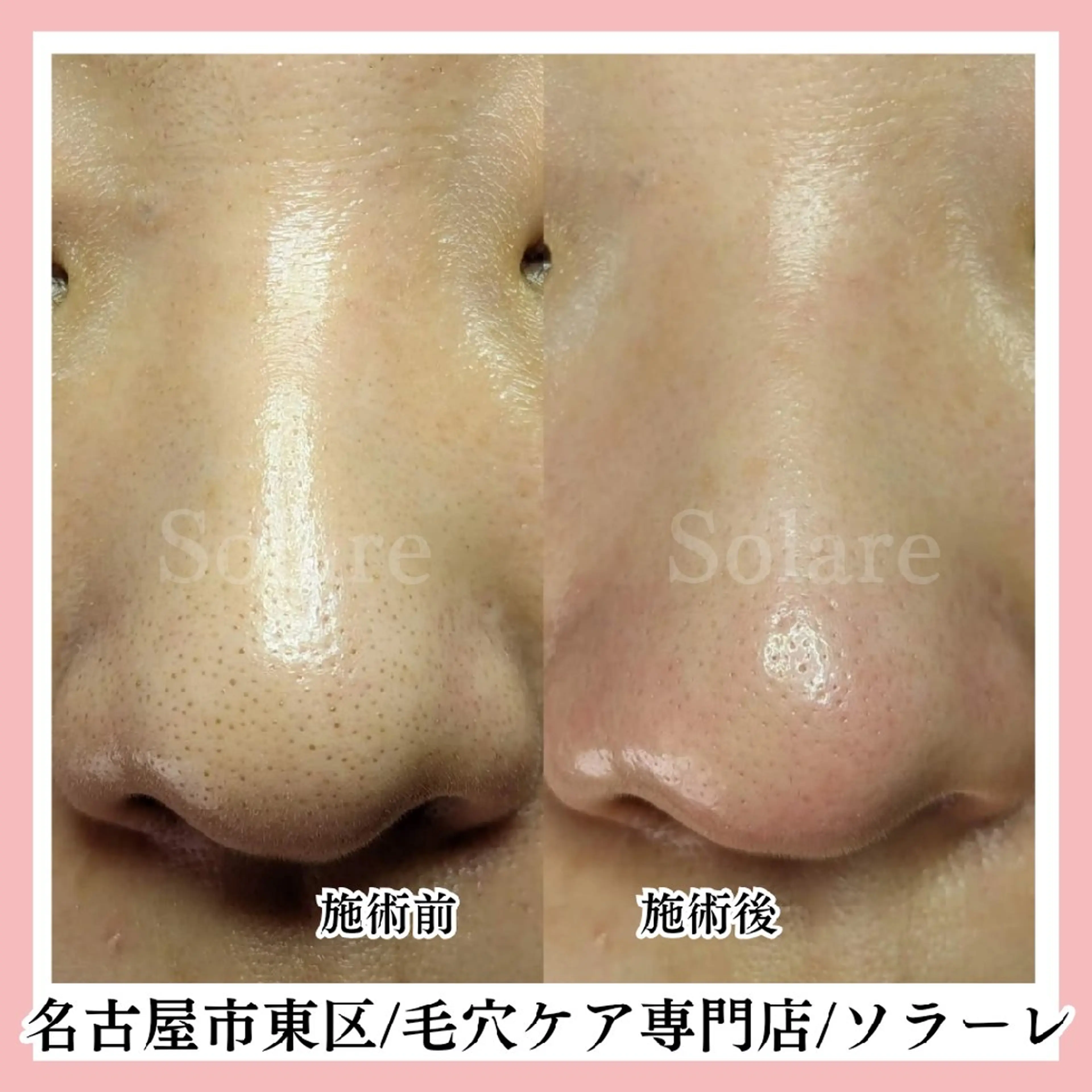  毛穴洗浄・まつ毛 の専門店 ソラーレのエステ・リラクイメージ