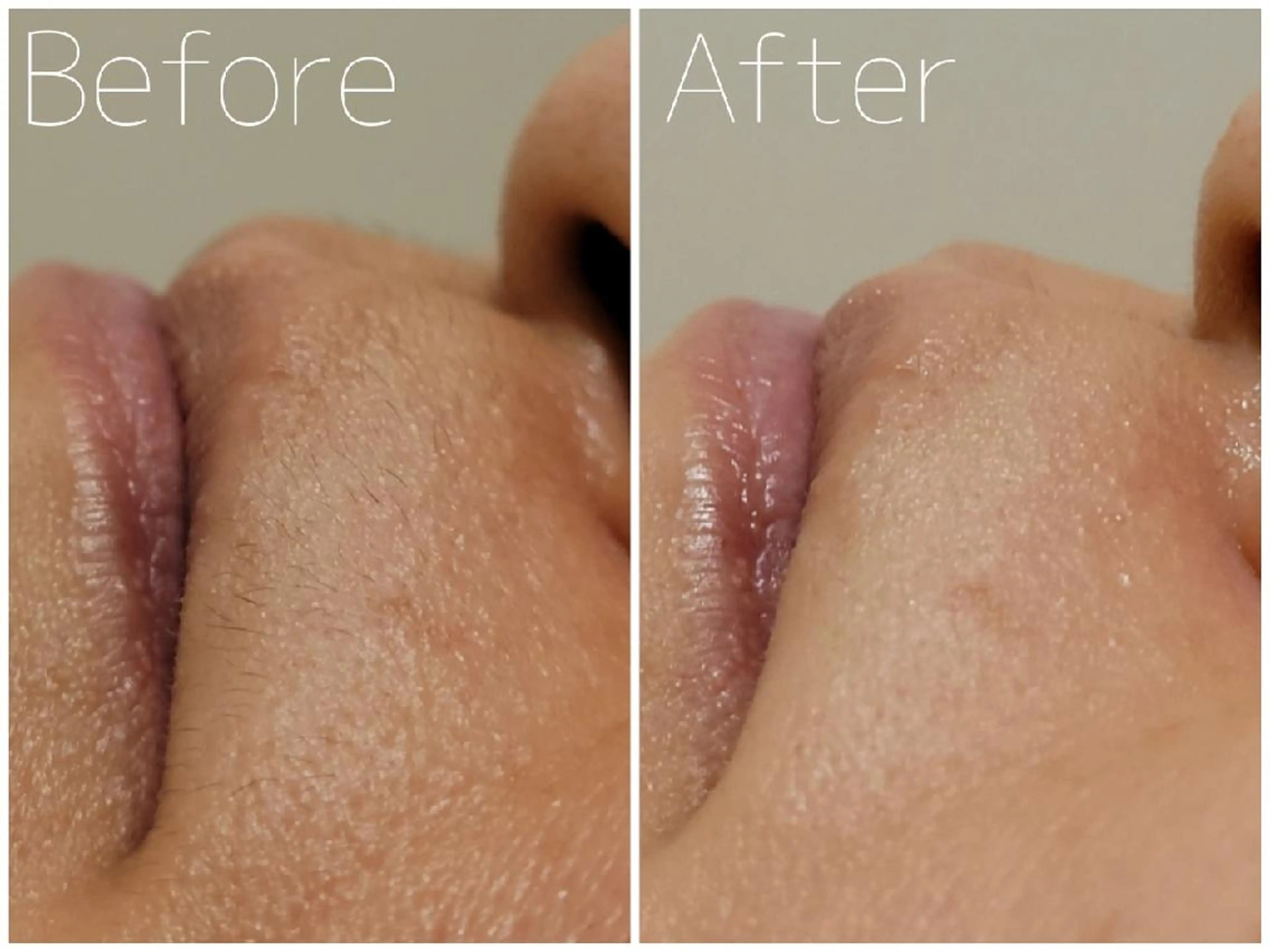 脱毛 毛穴/肌管理/痩身/ ボディケア/satoのエステ・リラクイメージ