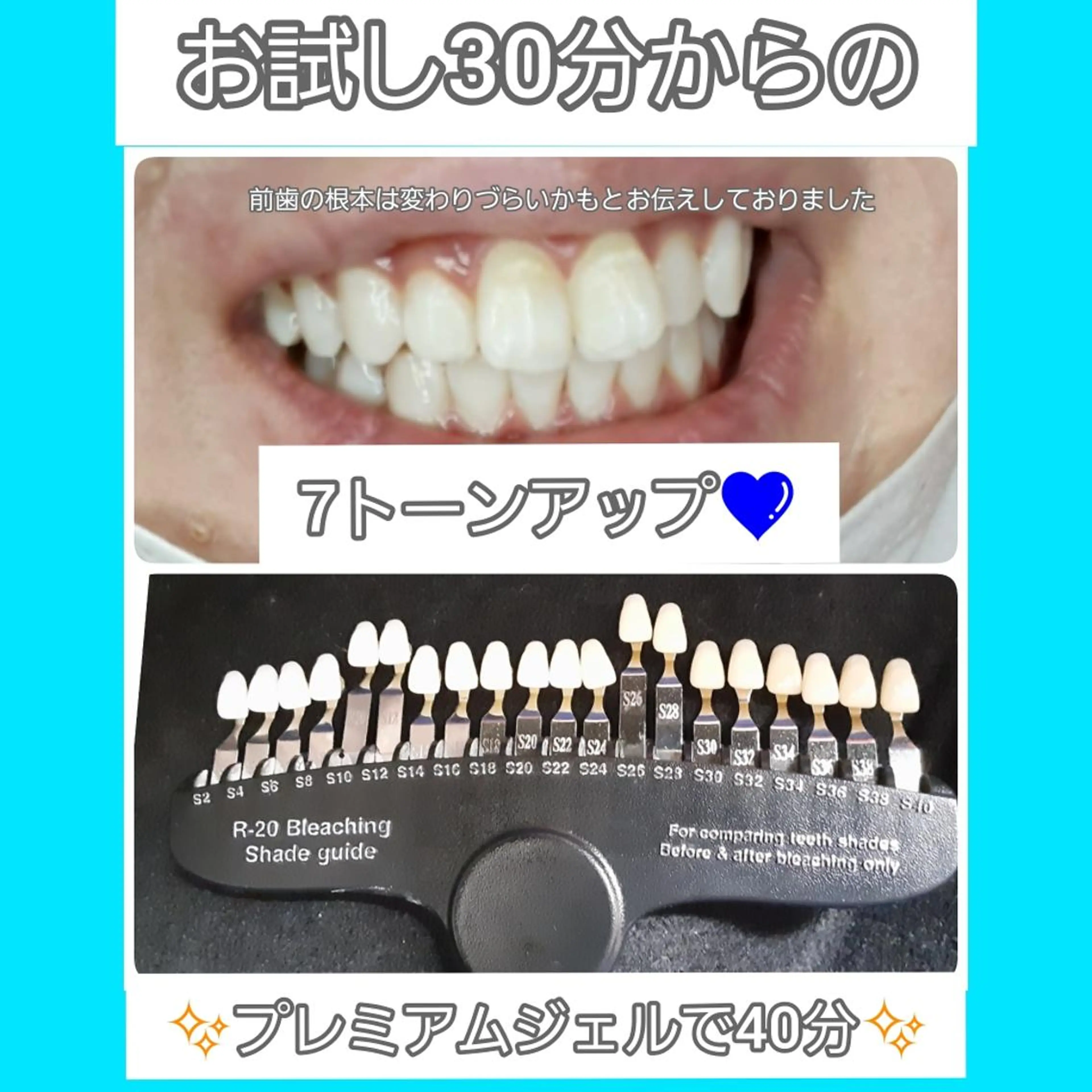 五十嵐 蓮のその他イメージ