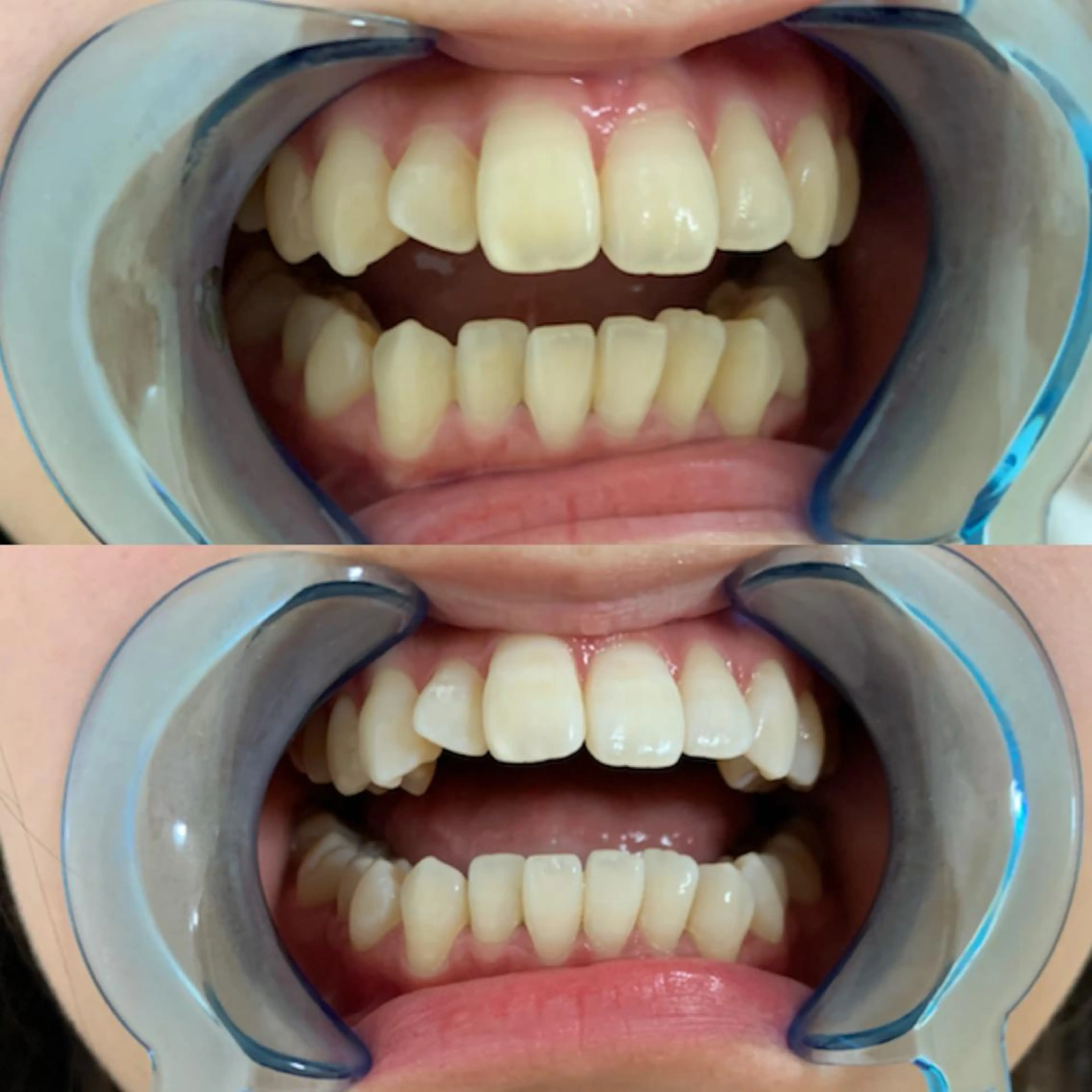 その他 藤本 真心のネイルデザイン