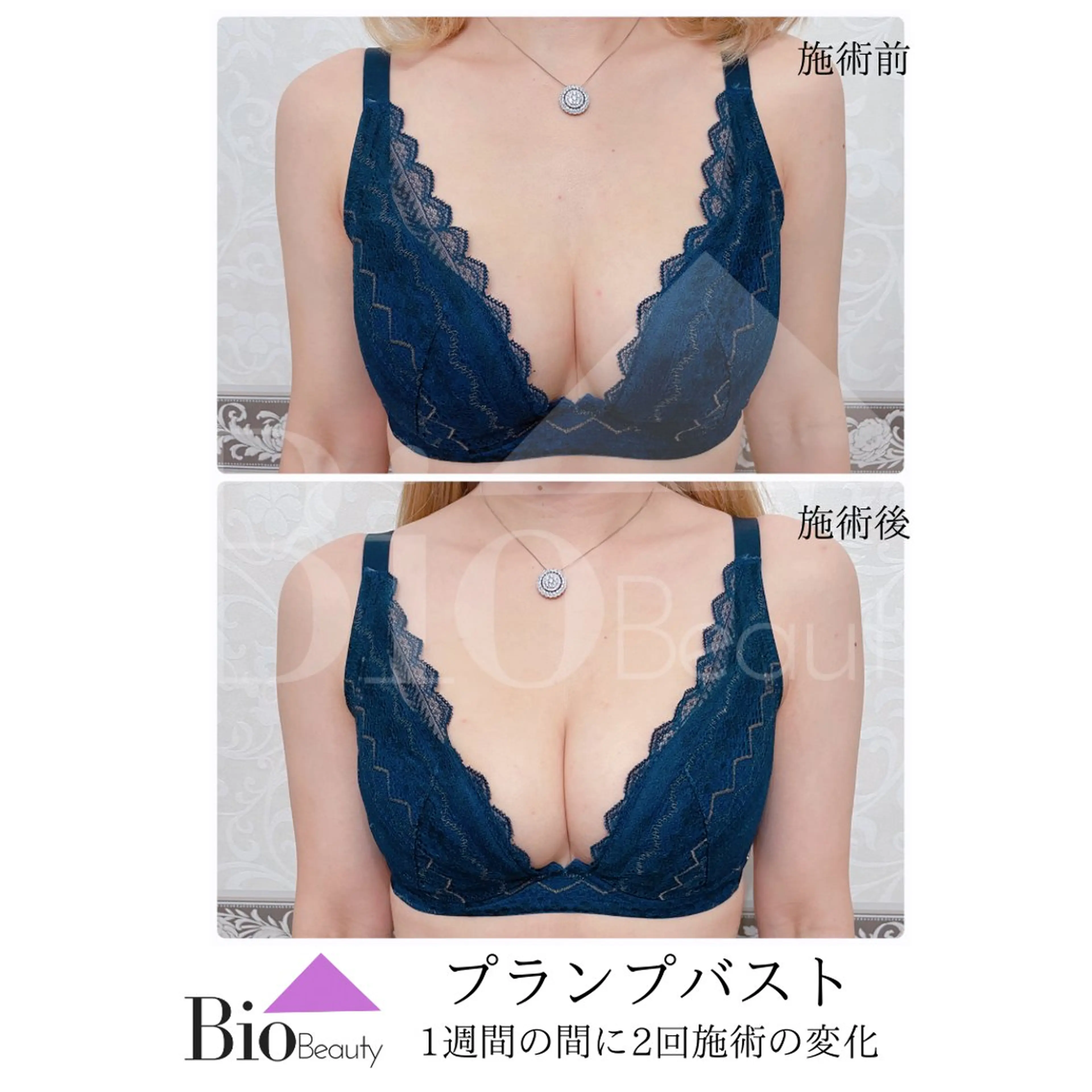 エステ Bio Beauty 神戸本店所属・エステ豊胸マイスター 中前のエステ・リラクイメージ