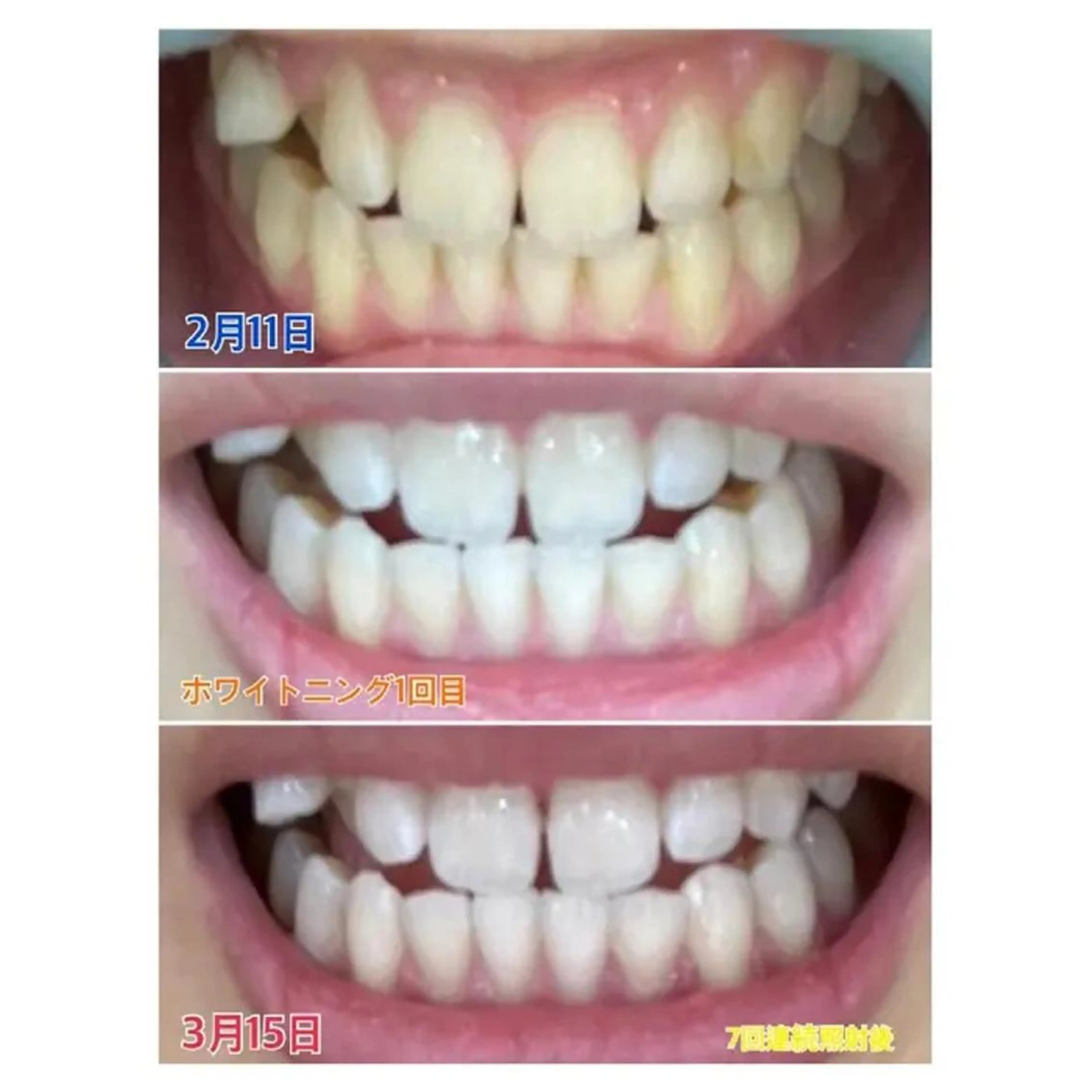 M渋谷店所属・M渋谷 ホワイトニングのエステ・リラクイメージ