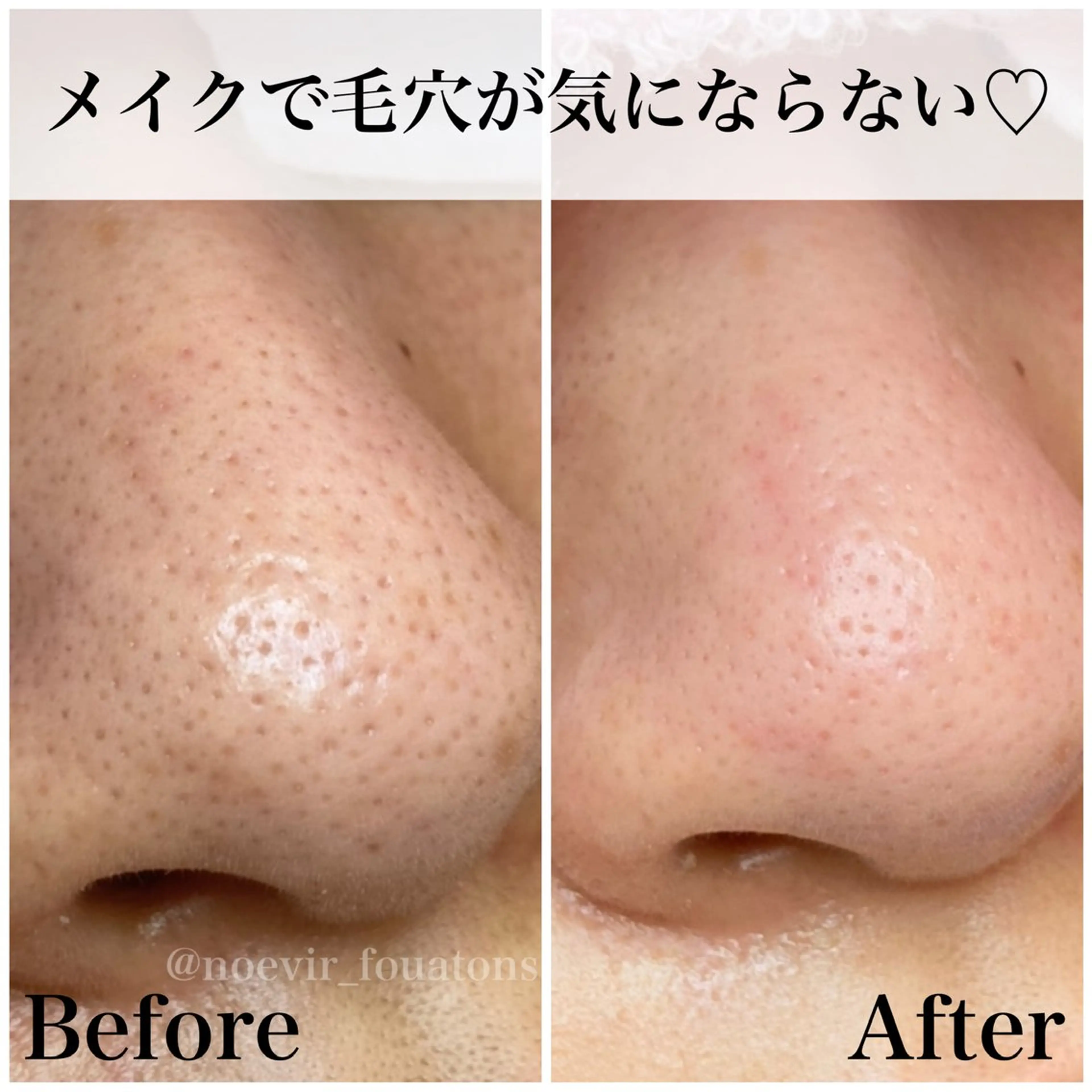 フェイシャルエステFOUATONS*所属・フェイシャルエステ ふわっとんのエステ・リラクイメージ