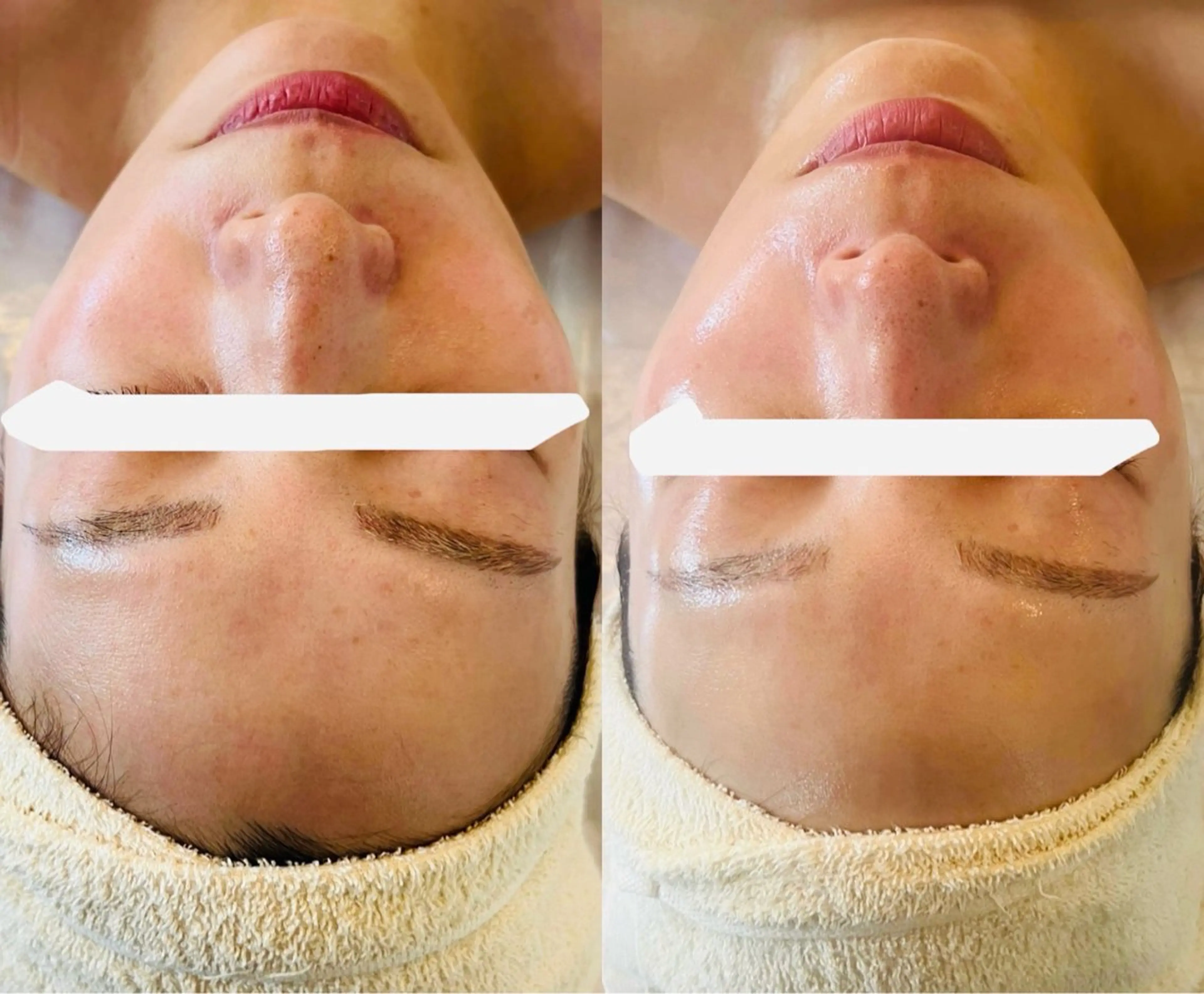 エステ beauty SalonRcoinのマツエク・マツパデザイン