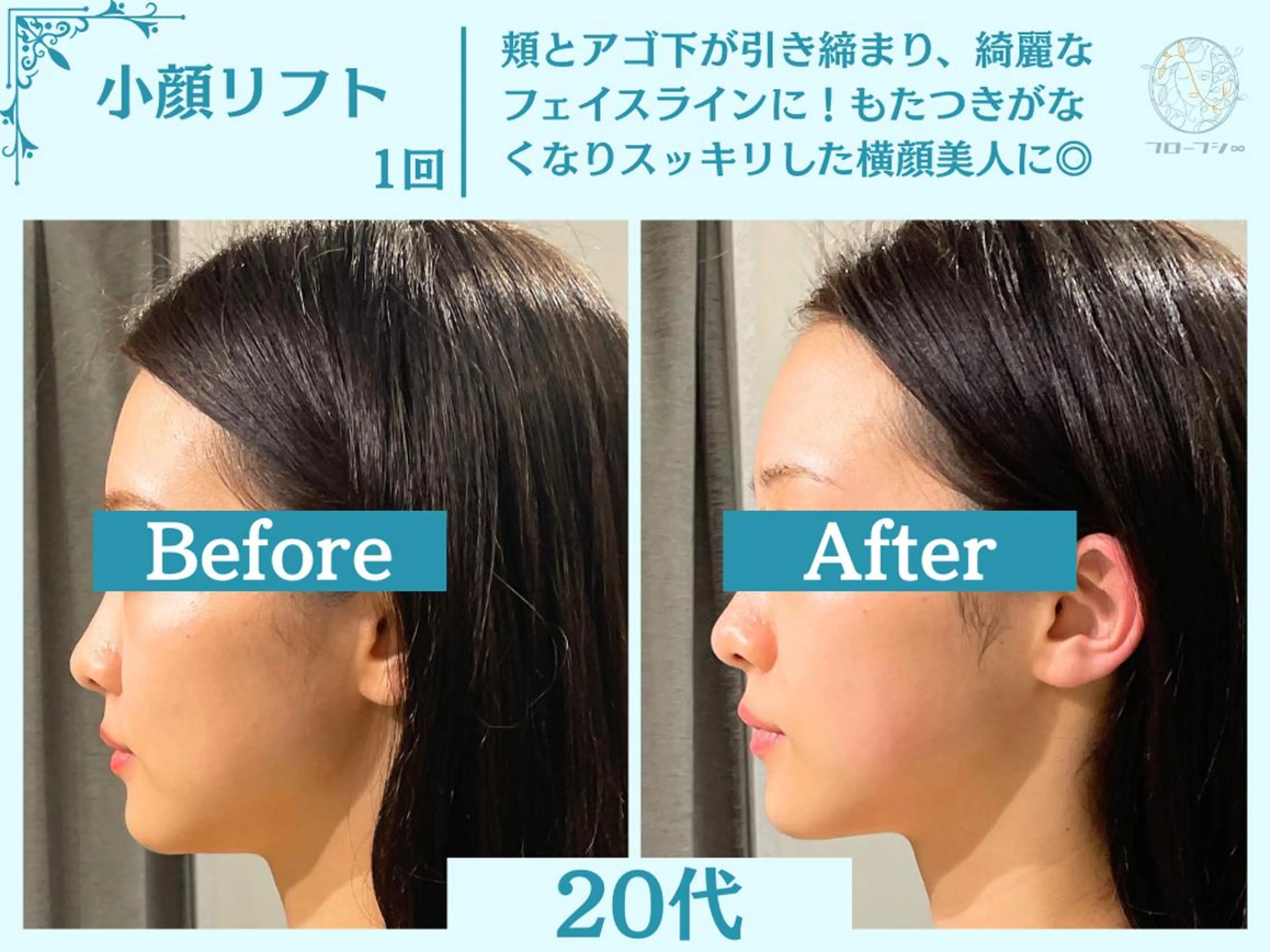 エステ リラク 部分痩せ♥️小顔専門 MIKUのエステ・リラクイメージ