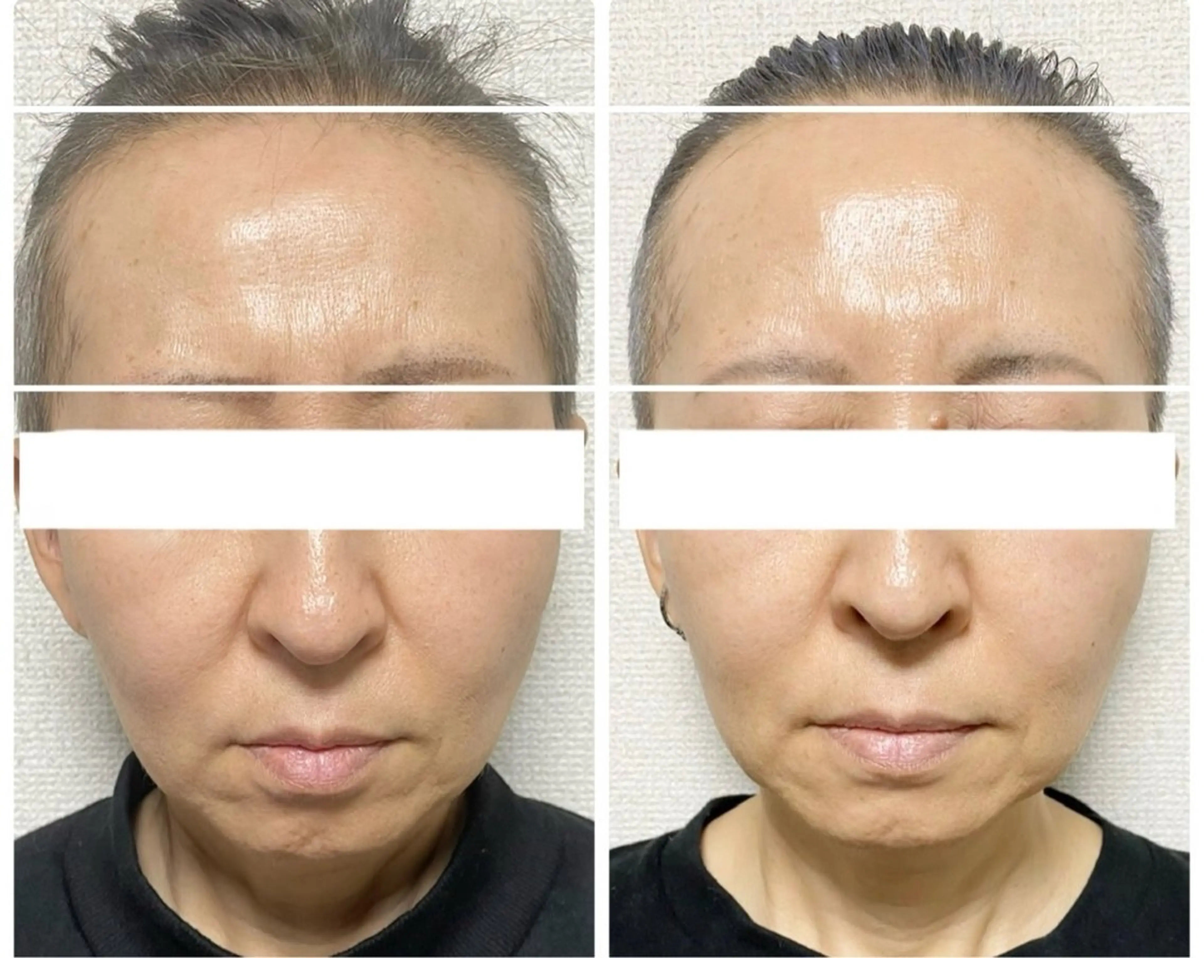 【特別価格】美肌エイジングケアフェイシャル【当店フェイシャル人気No1を最大3回まで利用可能】※数量限定の写真