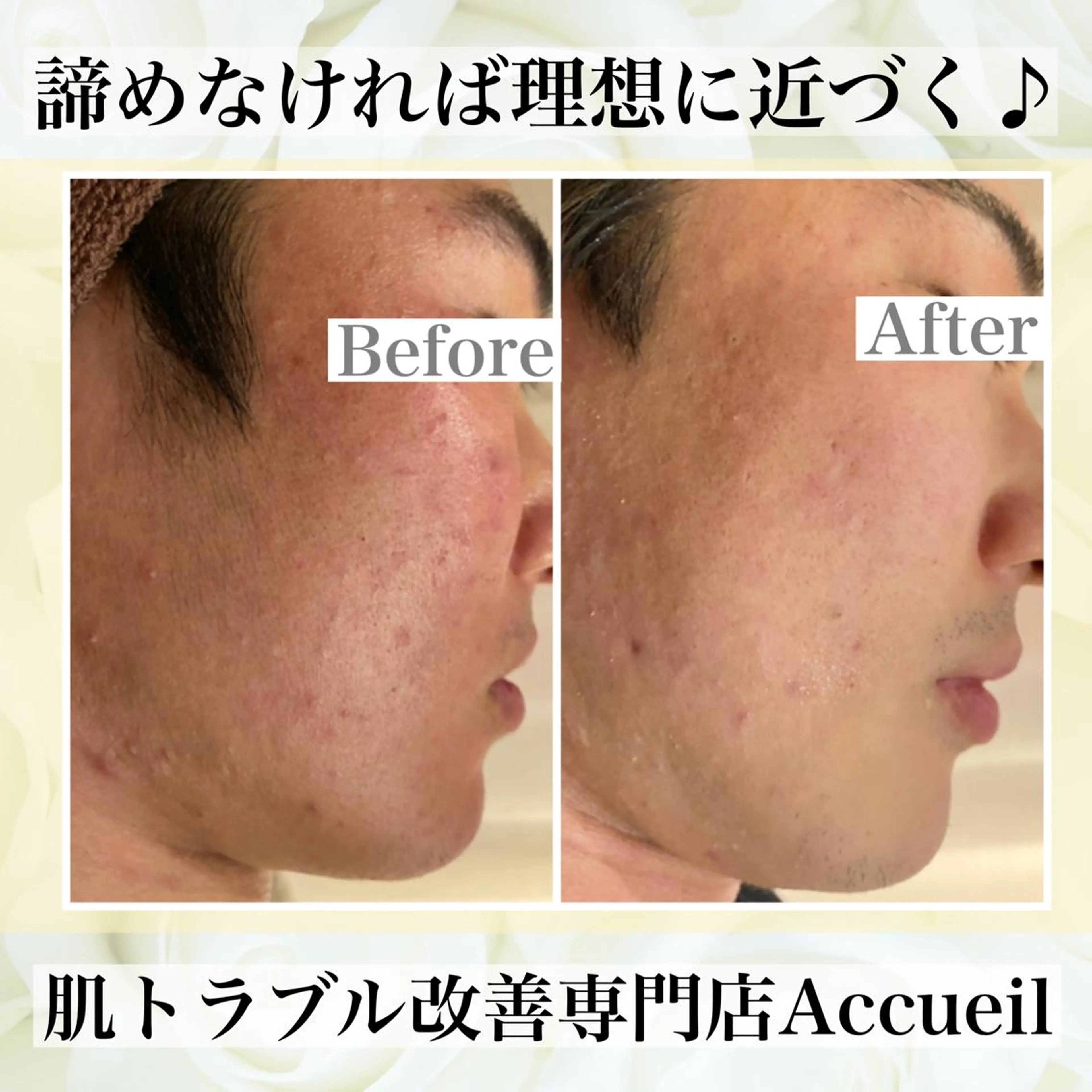 ミディアム カラー パーマ ヘアアレンジ メンズ キッズ ネイル マツエク・マツパ エステ リラク ニキビ・肌質改善専門 ♡人生が変わるサロンのエステ・リラクイメージ