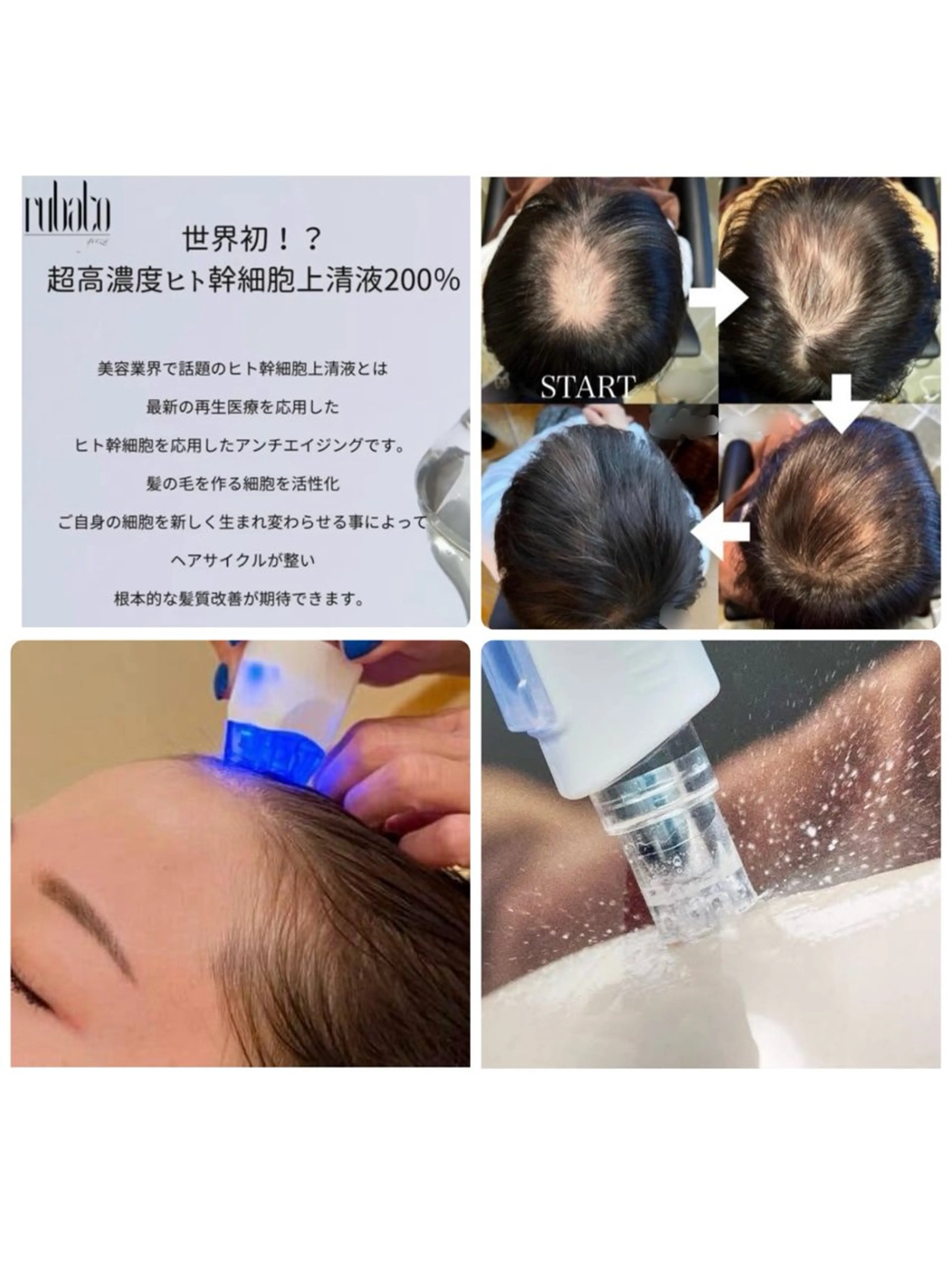 【高濃度ヒト幹細胞】発毛促進ヘッドスパ エアバリ&デンキバリブラシ&ヘッドマッサージコースの写真