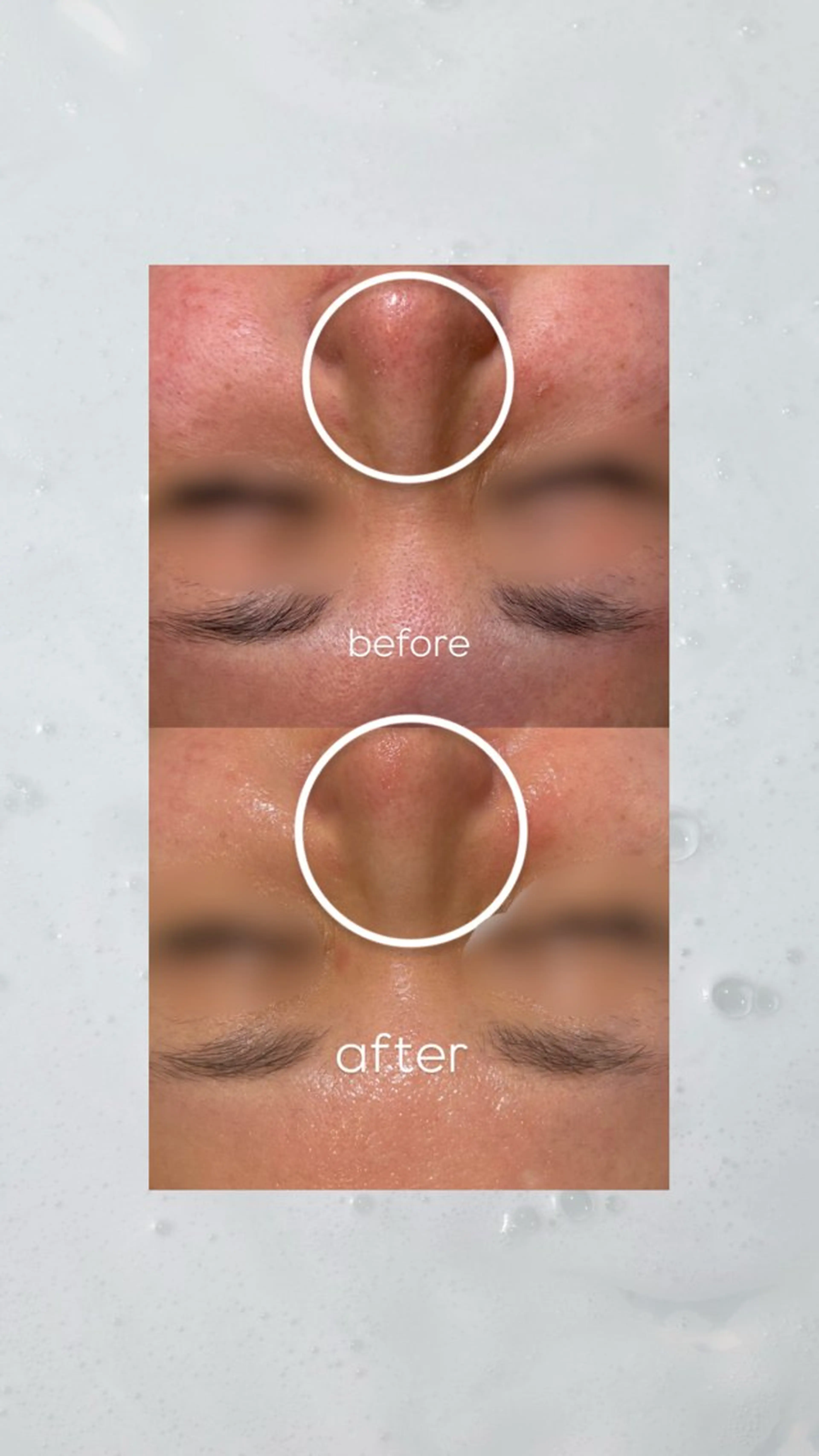 メナードフェイシャルサロン伏木所属・ii＋ いいプラスのエステ・リラクイメージ