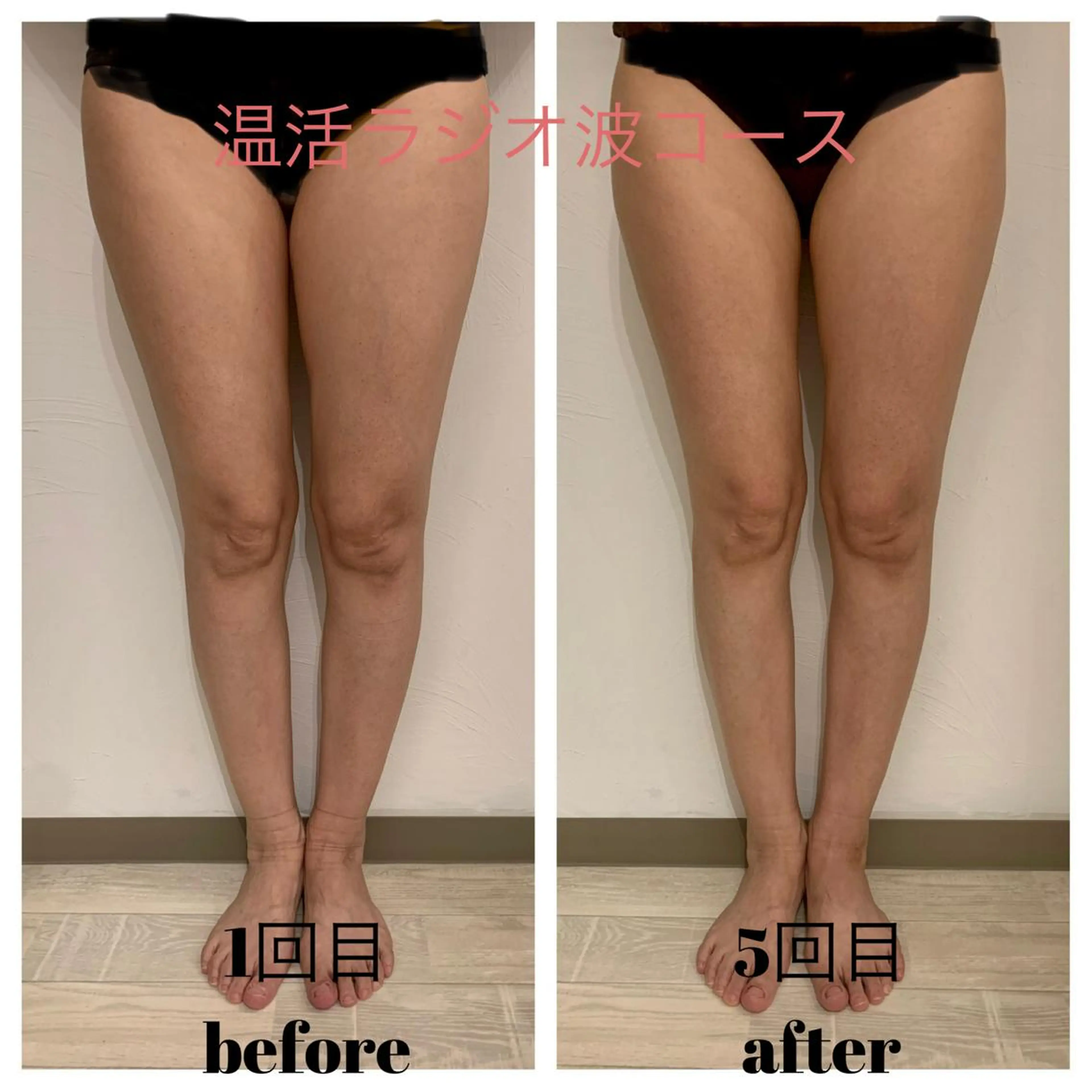 リンパマッサージ&ピラティスmimoza所属・リンパマッサージ mimozaのエステ・リラクイメージ