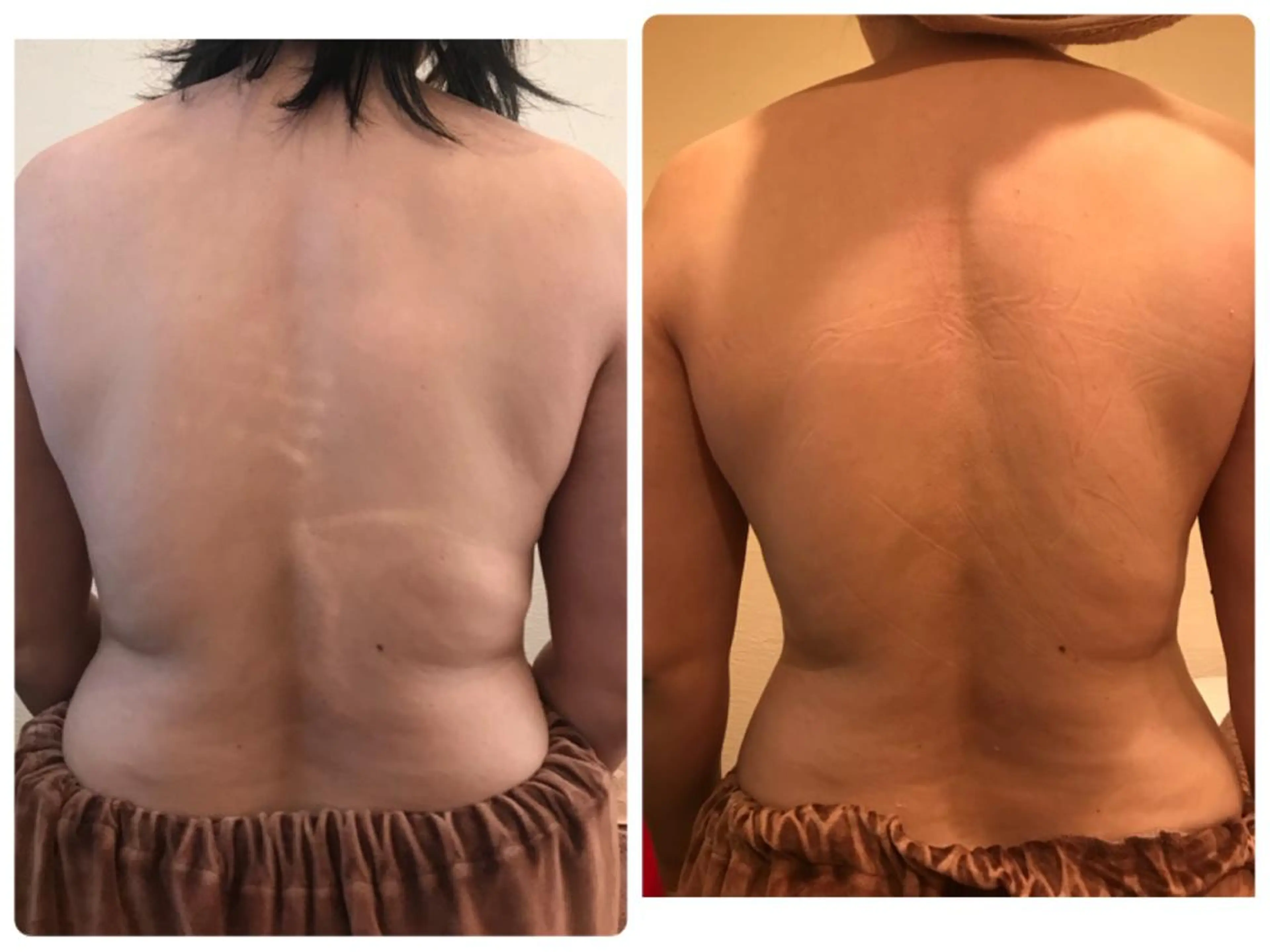 【初回限定】レディースホルミシスリンパコースの写真