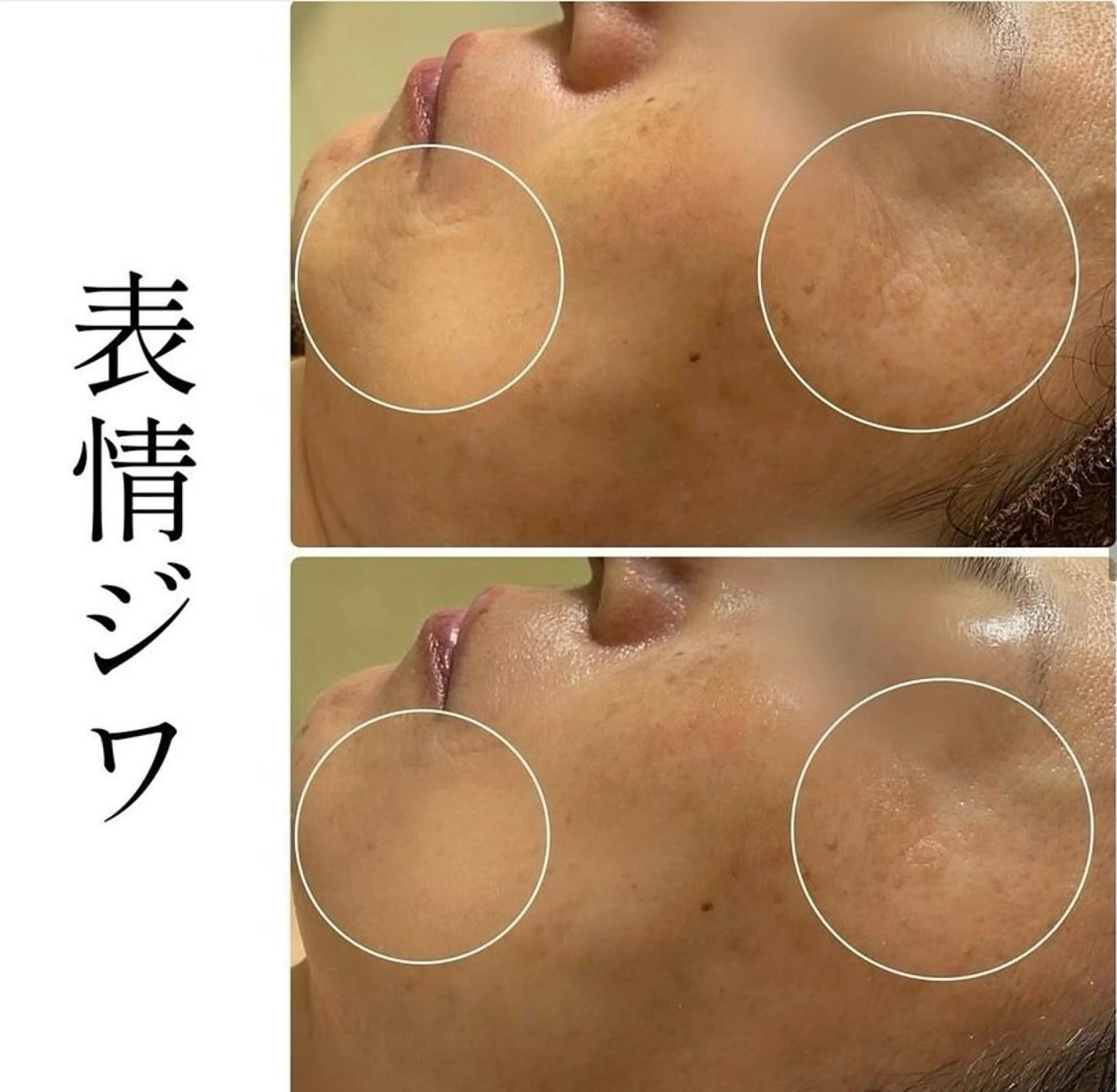 エステ ハーブピーリング専門 BIOPLUS＋川崎のエステ・リラクイメージ