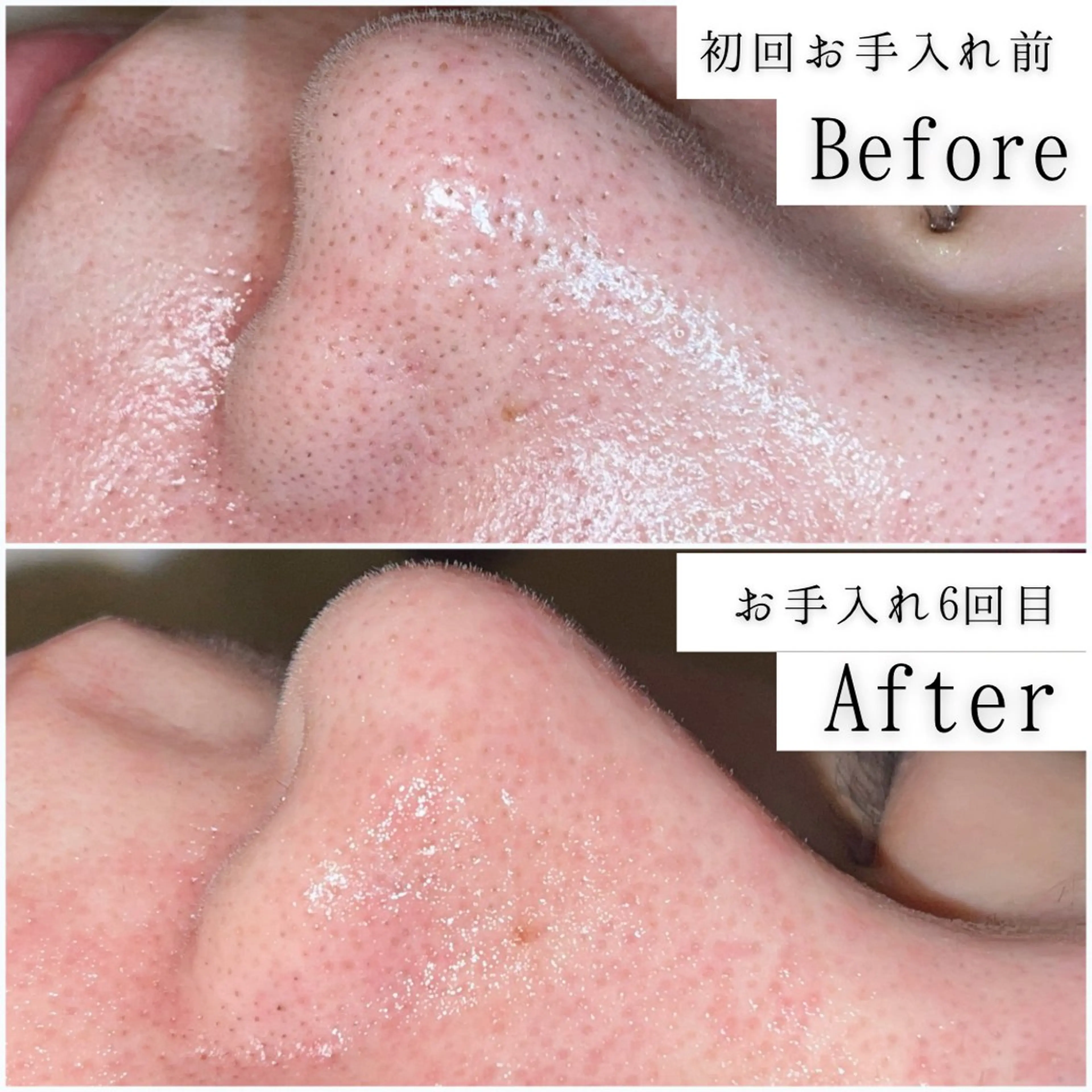 エステ SELF  BEAUTY gracia浦添店所属・gracia 浦添店のその他イメージ