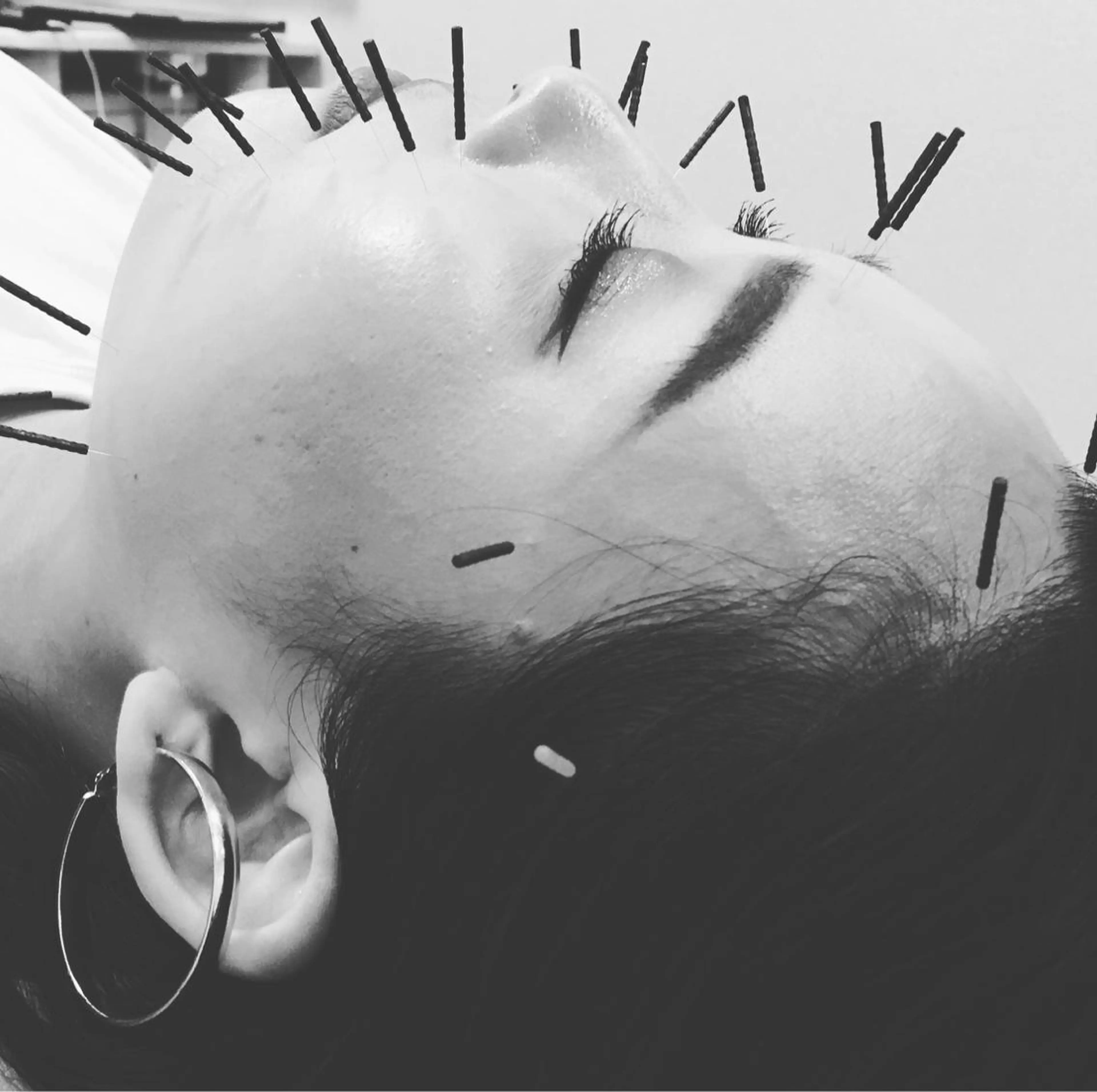 鍼灸整体院　蕾所属・美容鍼 蕾【谷町六丁目】のエステ・リラクイメージ