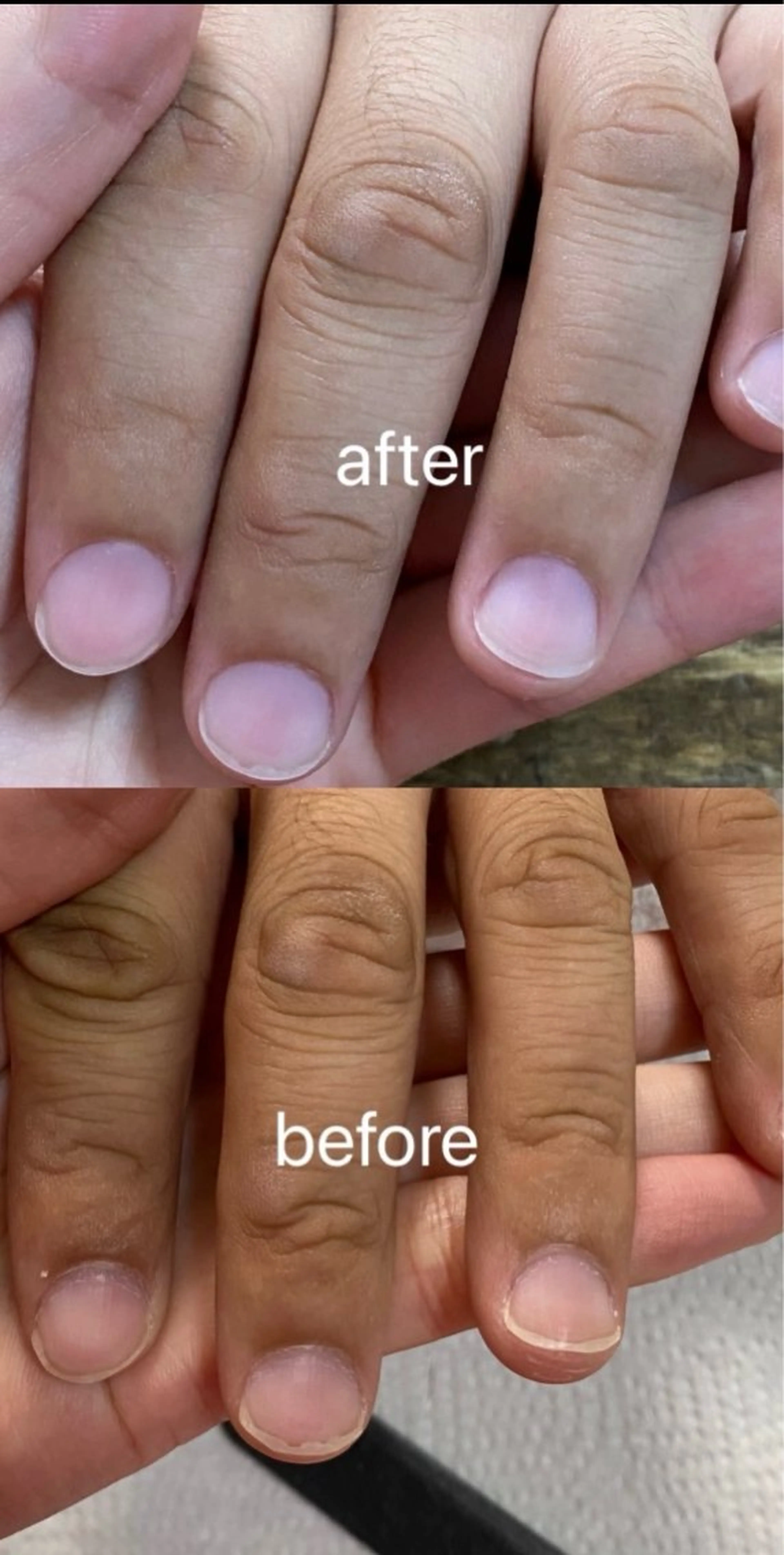 ハンドケアの写真