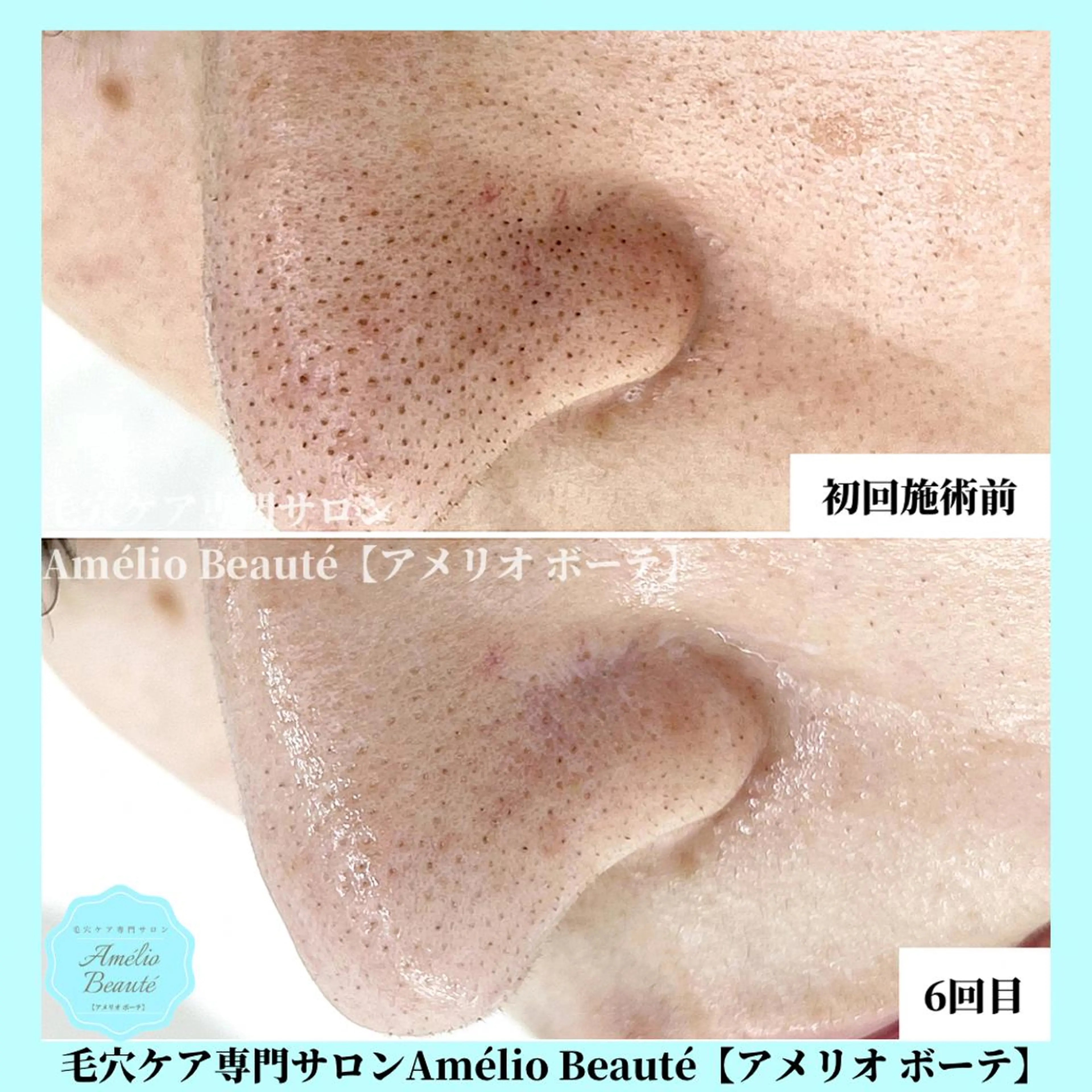 毛穴ケア専門サロン Amélio Beauté所属・毛穴ケア専門サロン アメリオボーテのその他イメージ