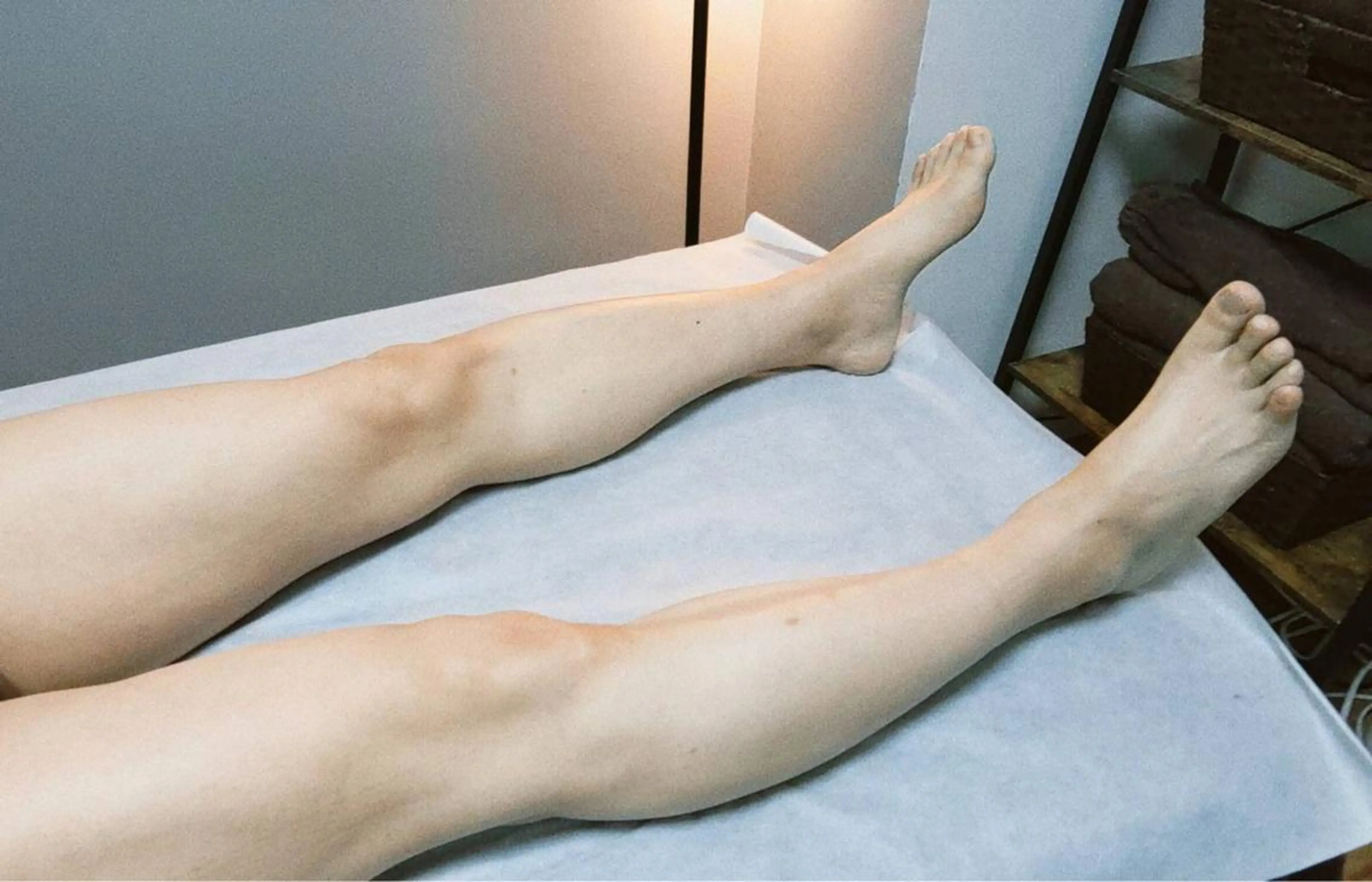 ★モニターメンズ脱毛★  両脚脱毛　(SHR脱毛)の写真