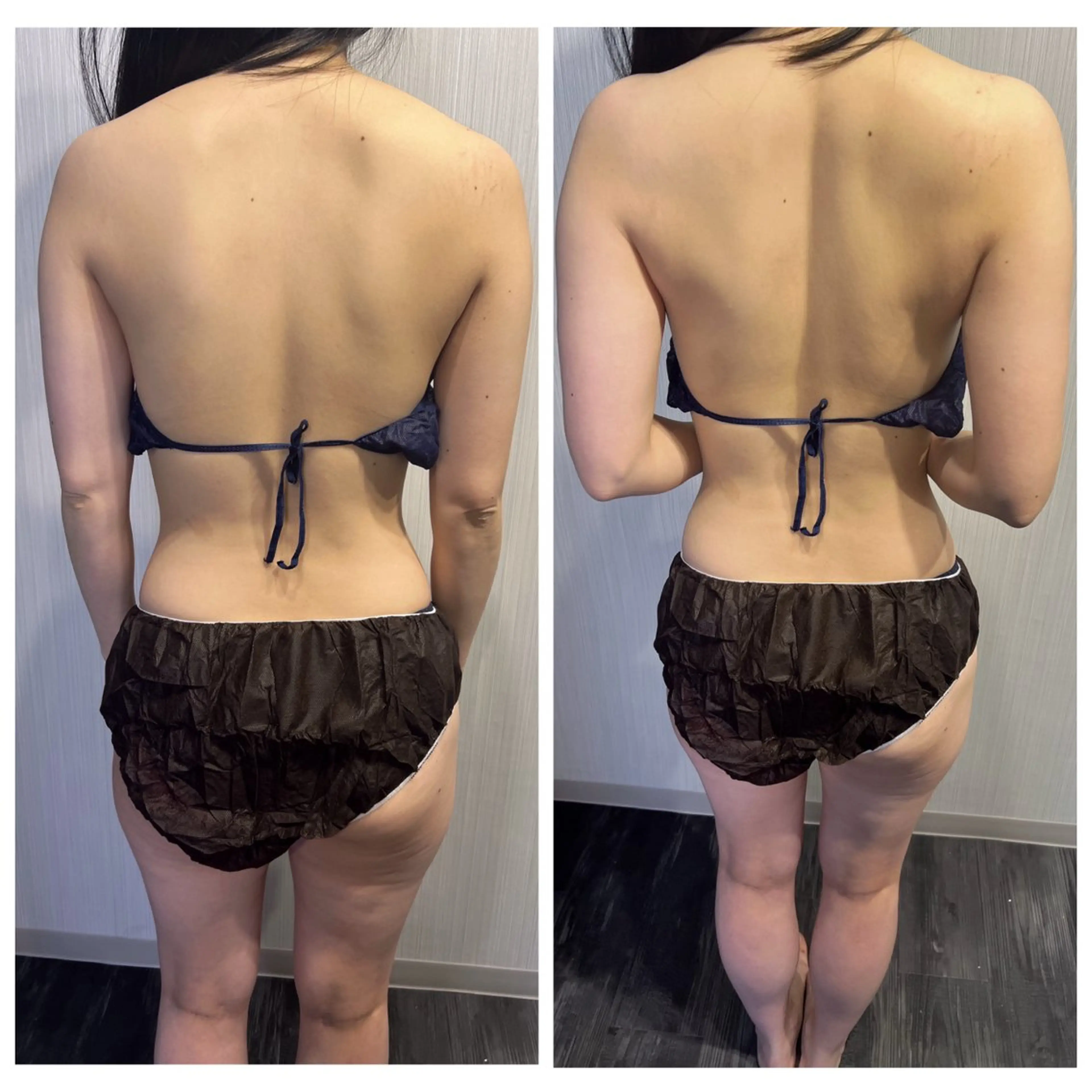 リラク Mythica 横浜 ハーブピーリング小顔のエステ・リラクイメージ