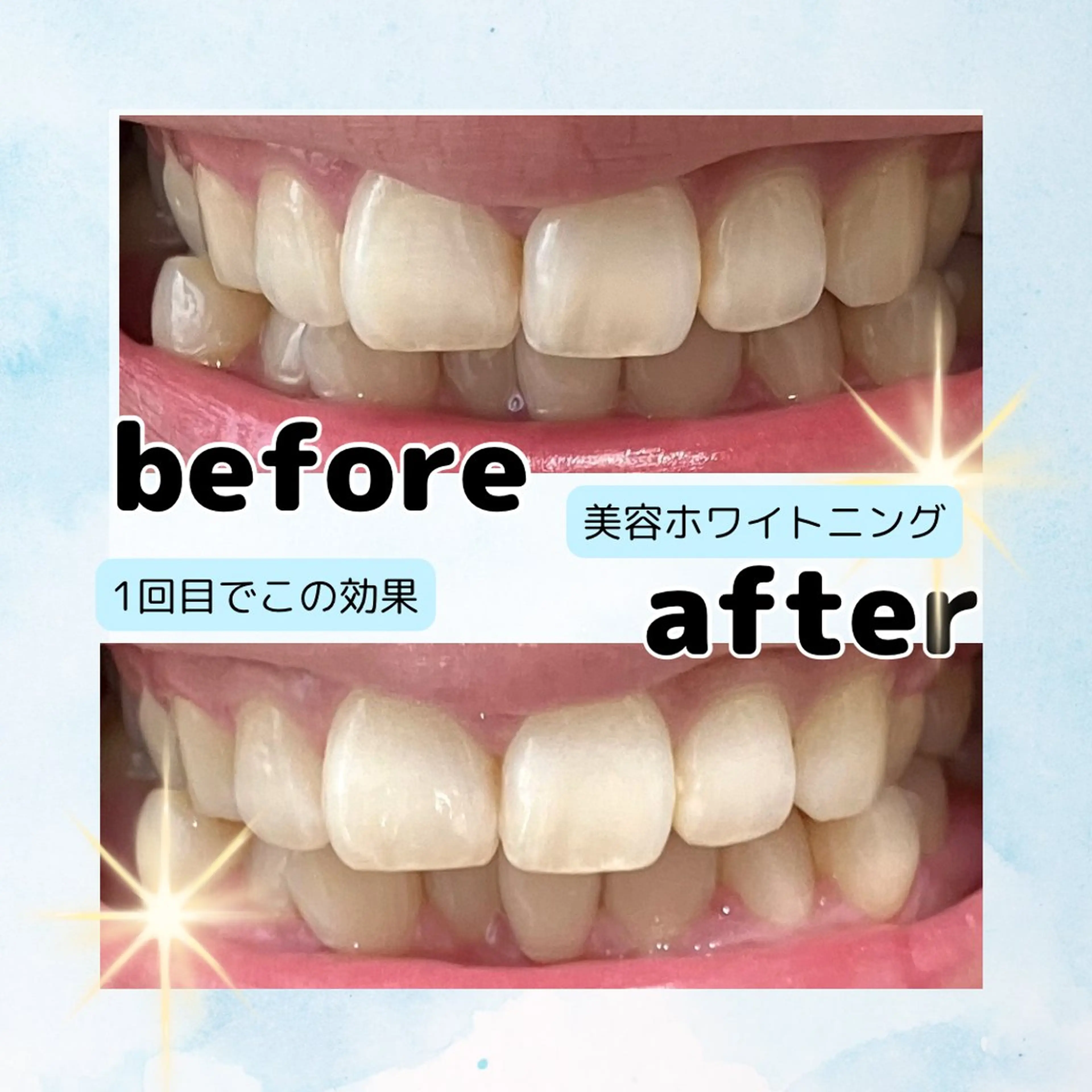 ホワイトニングサロン Soleilのその他イメージ