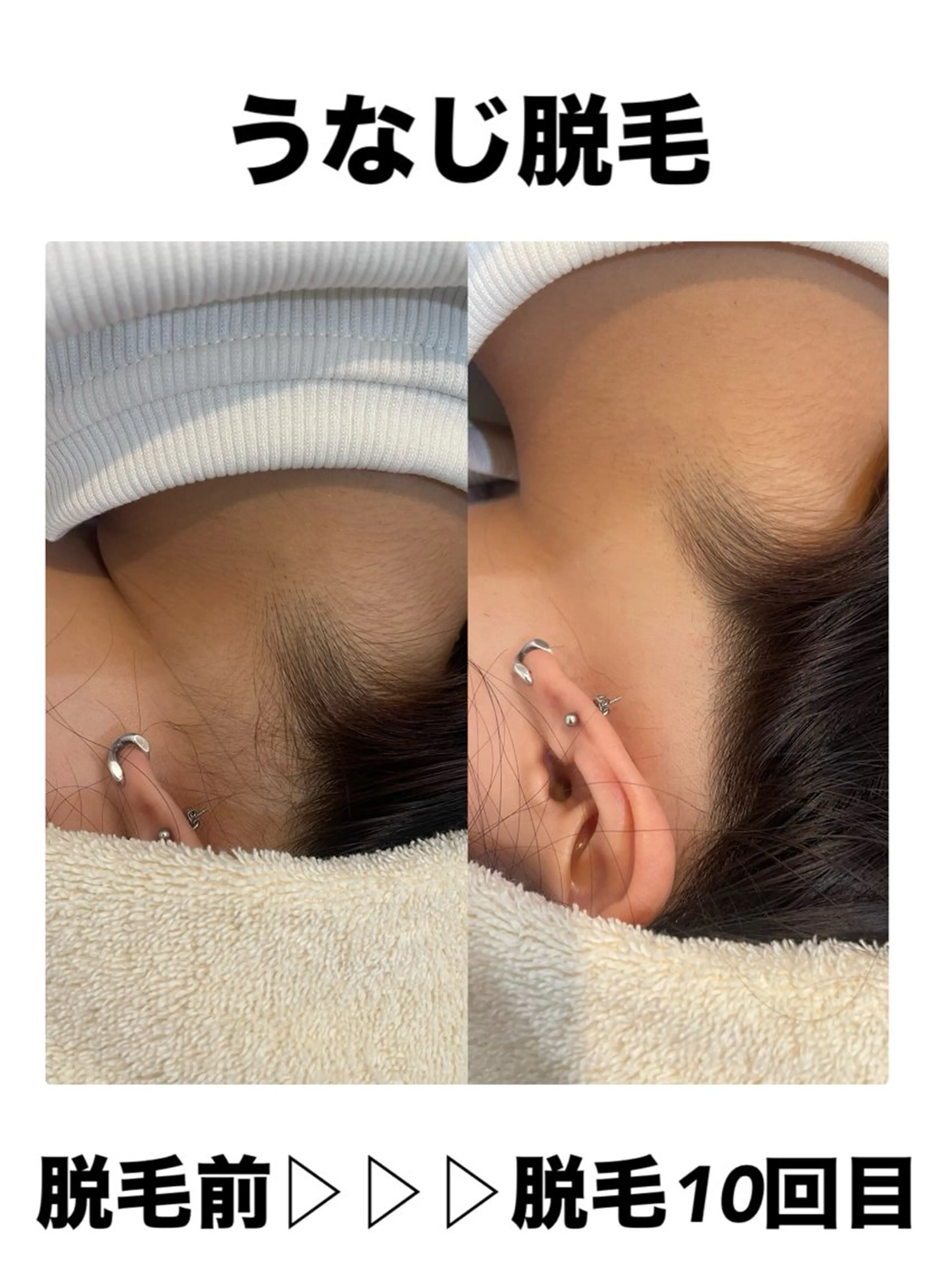 脱毛・眉毛・フェイス サロンN久留米店のその他イメージ