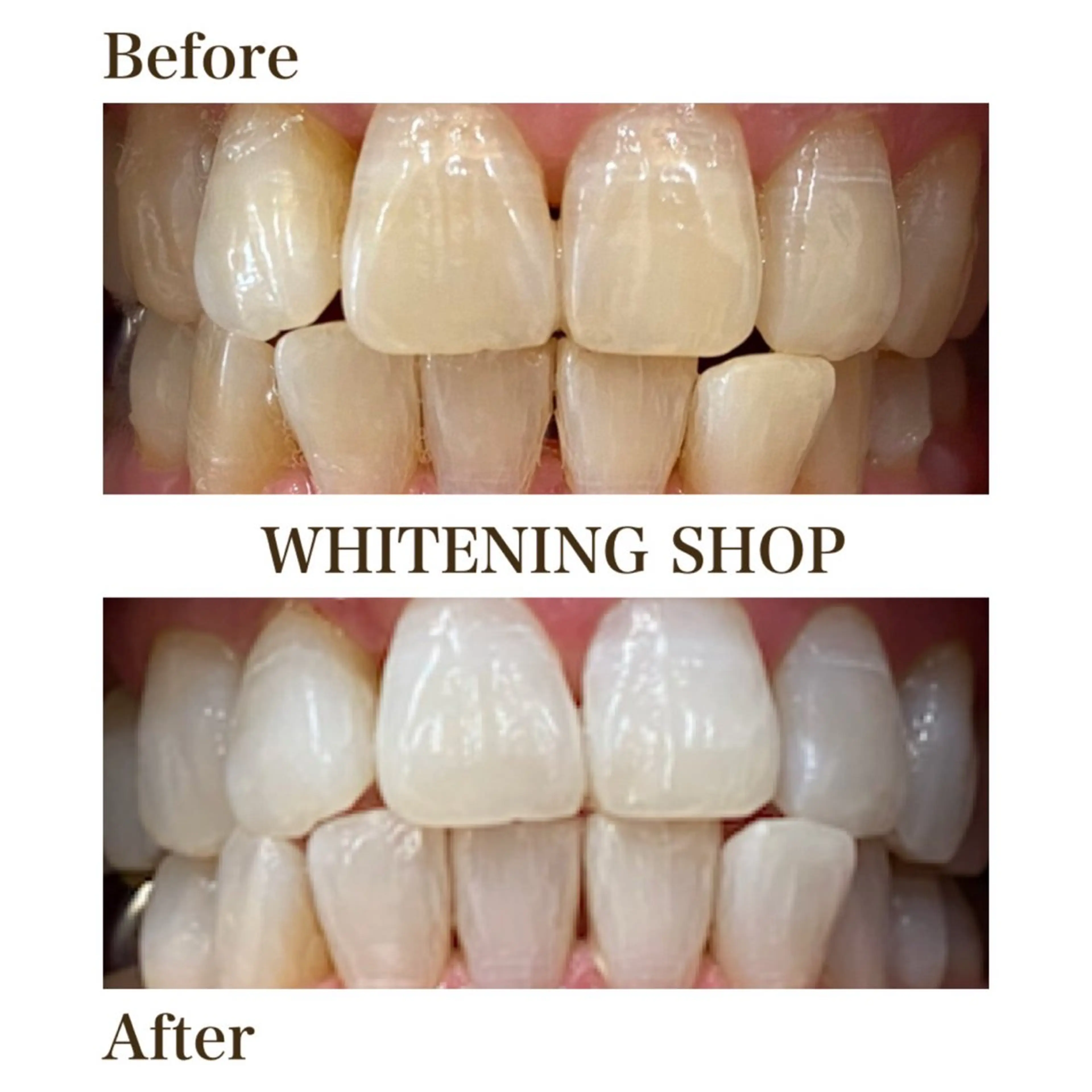 メンズ ホワイトニング ショップ川越店のエステ・リラクイメージ