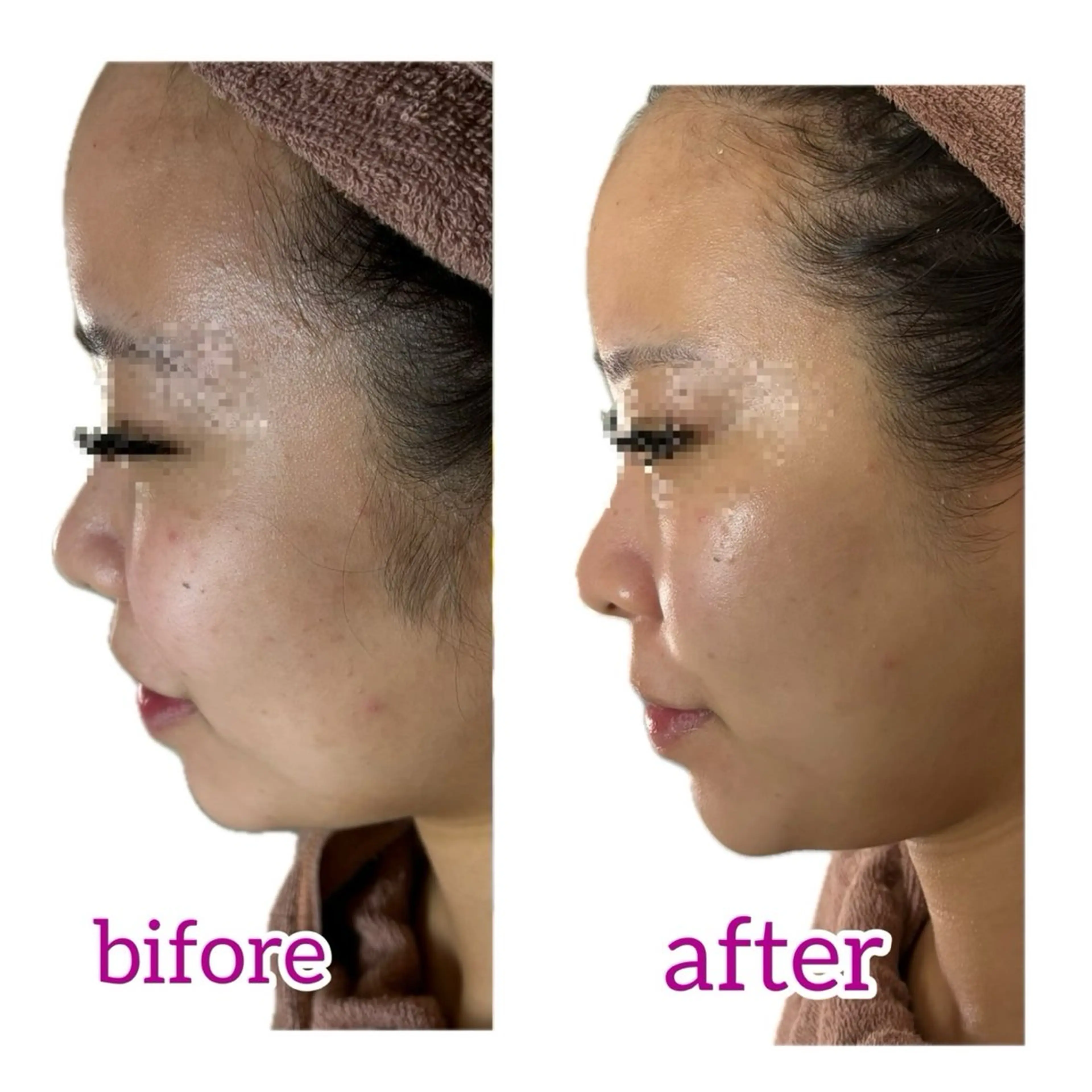 エステ リラク 透明感の肌Lino malieのエステ・リラクイメージ