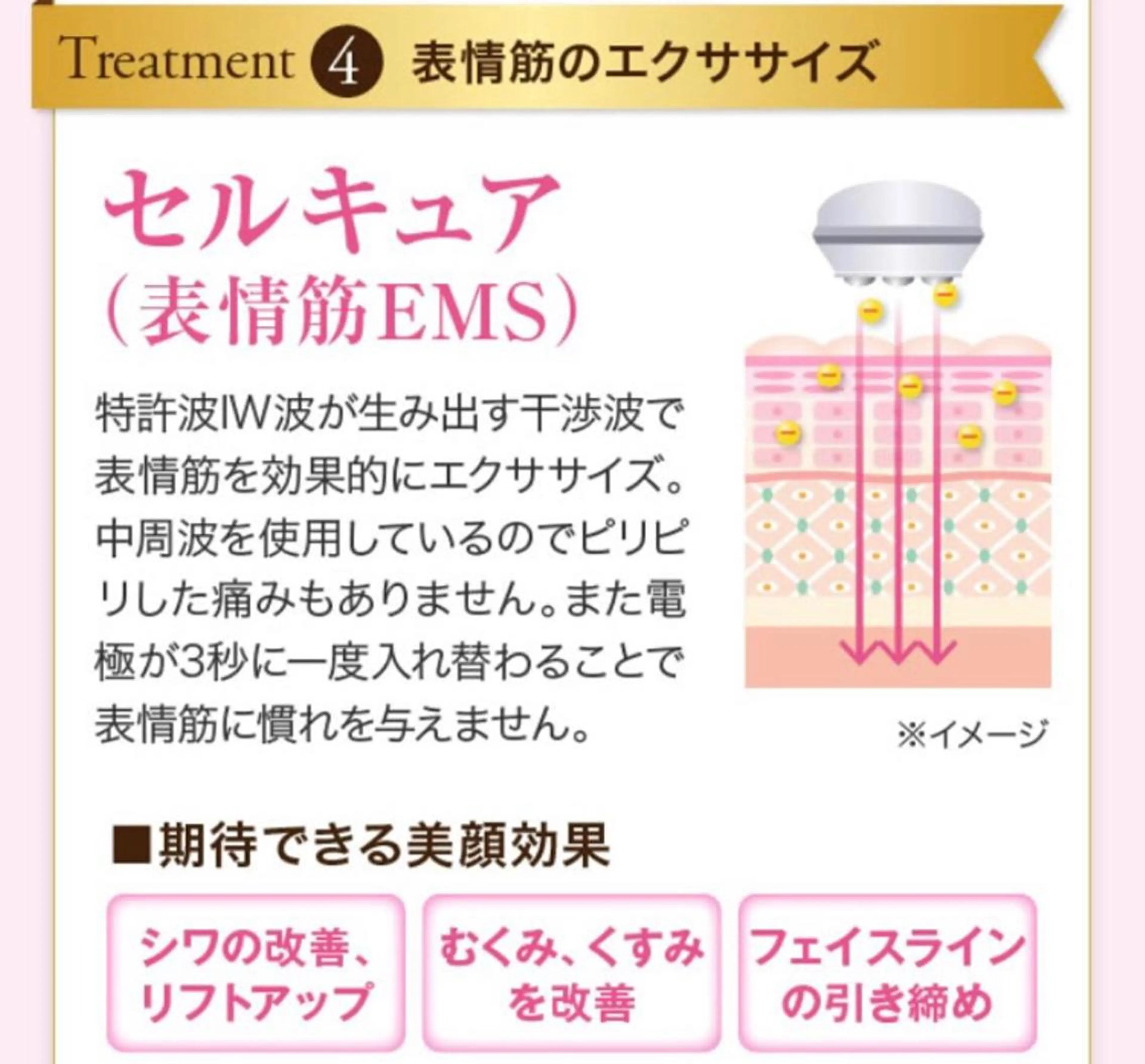 セルキュア4Tプラス！EMS表情筋アプローチコースの写真