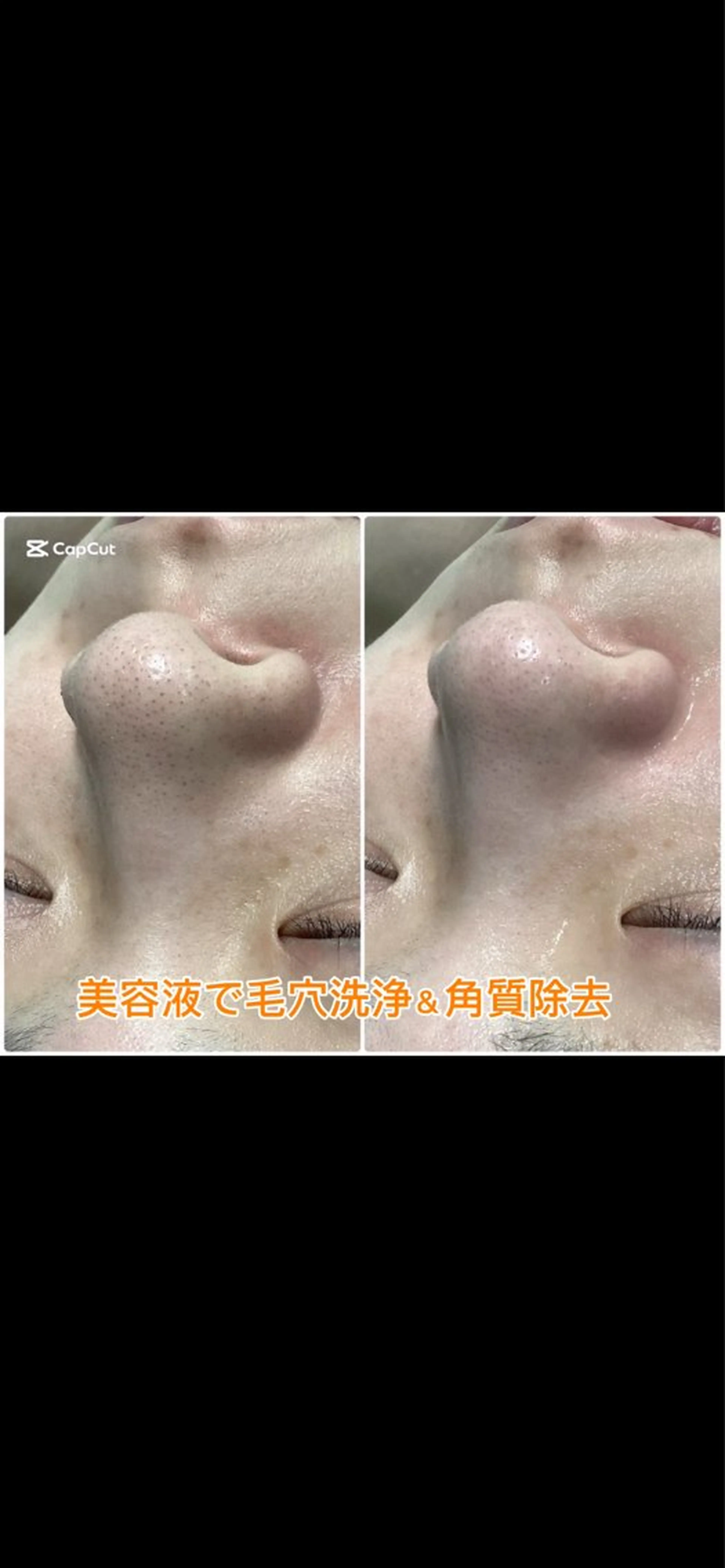 エステ M 🌱naturalのエステ・リラクイメージ