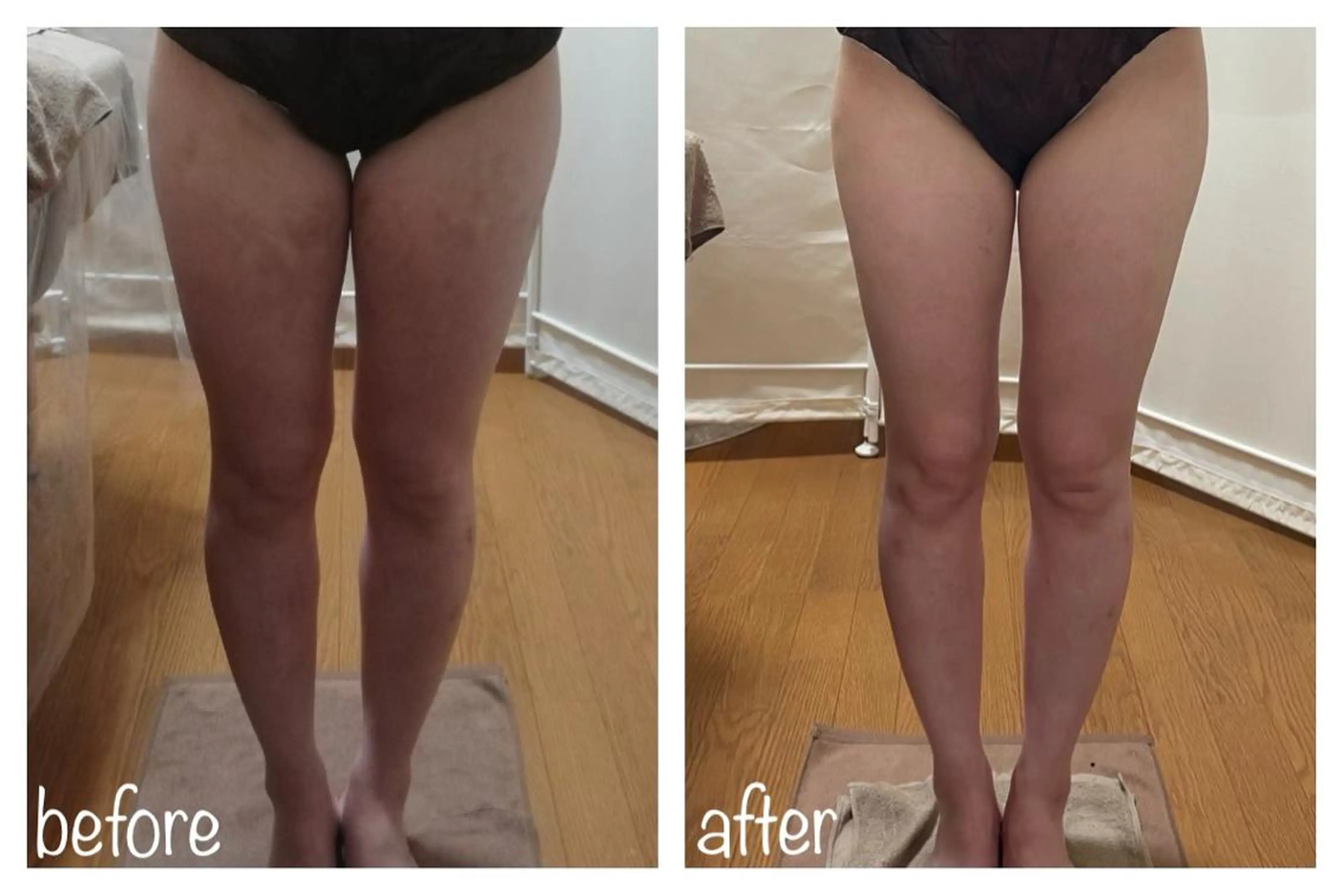 biloop所属・《痩身×疲労改善》 BILOOPのエステ・リラクイメージ