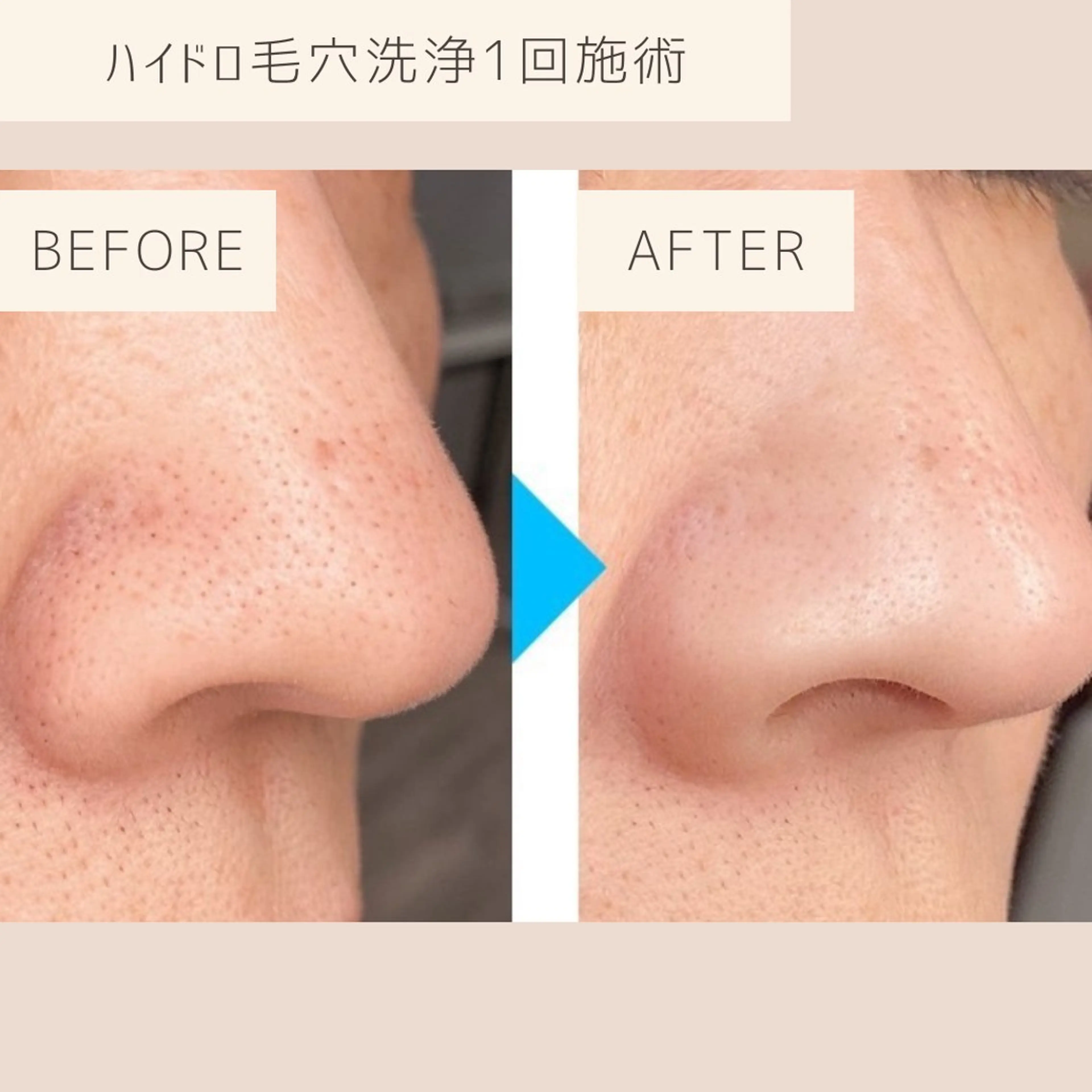 小顔&美肌品川店 Masqueradeのエステ・リラクイメージ