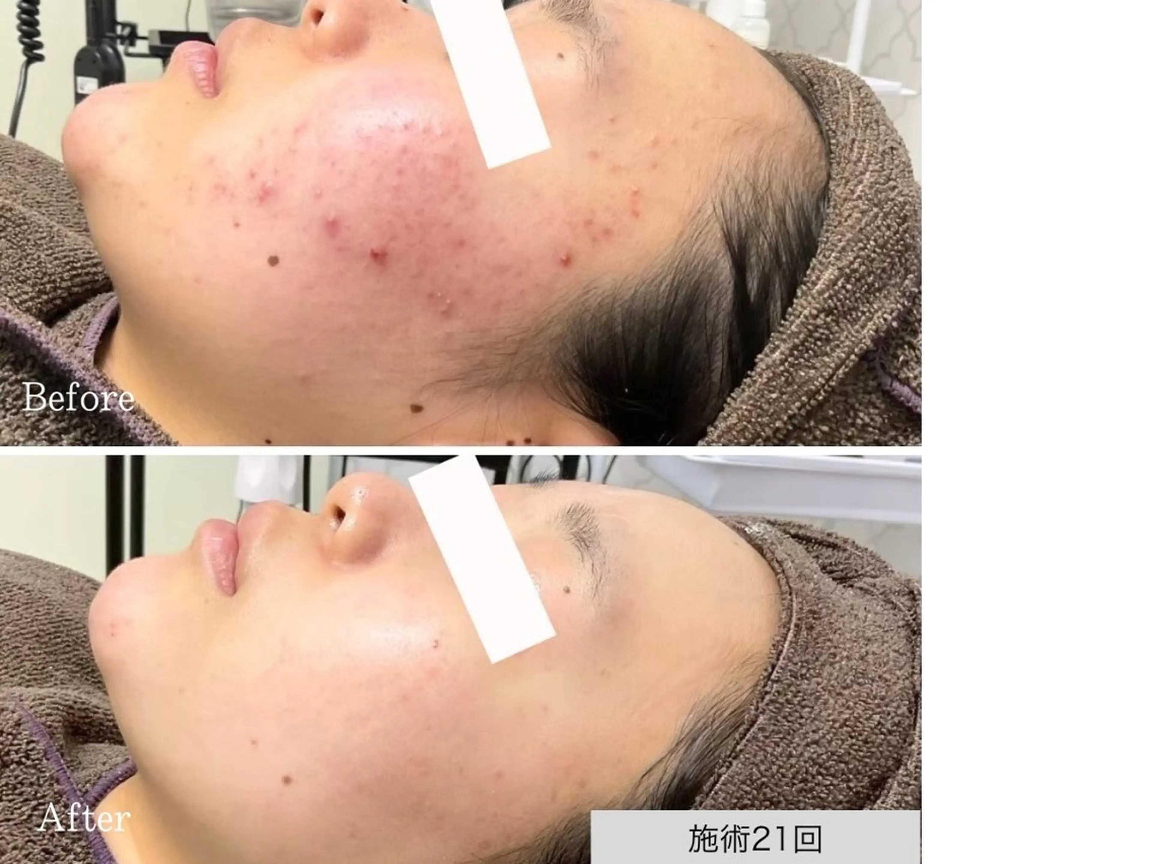 人気No.1【迷った方はこちら】当日ご相談◎何を選べばいいか分からない方の写真