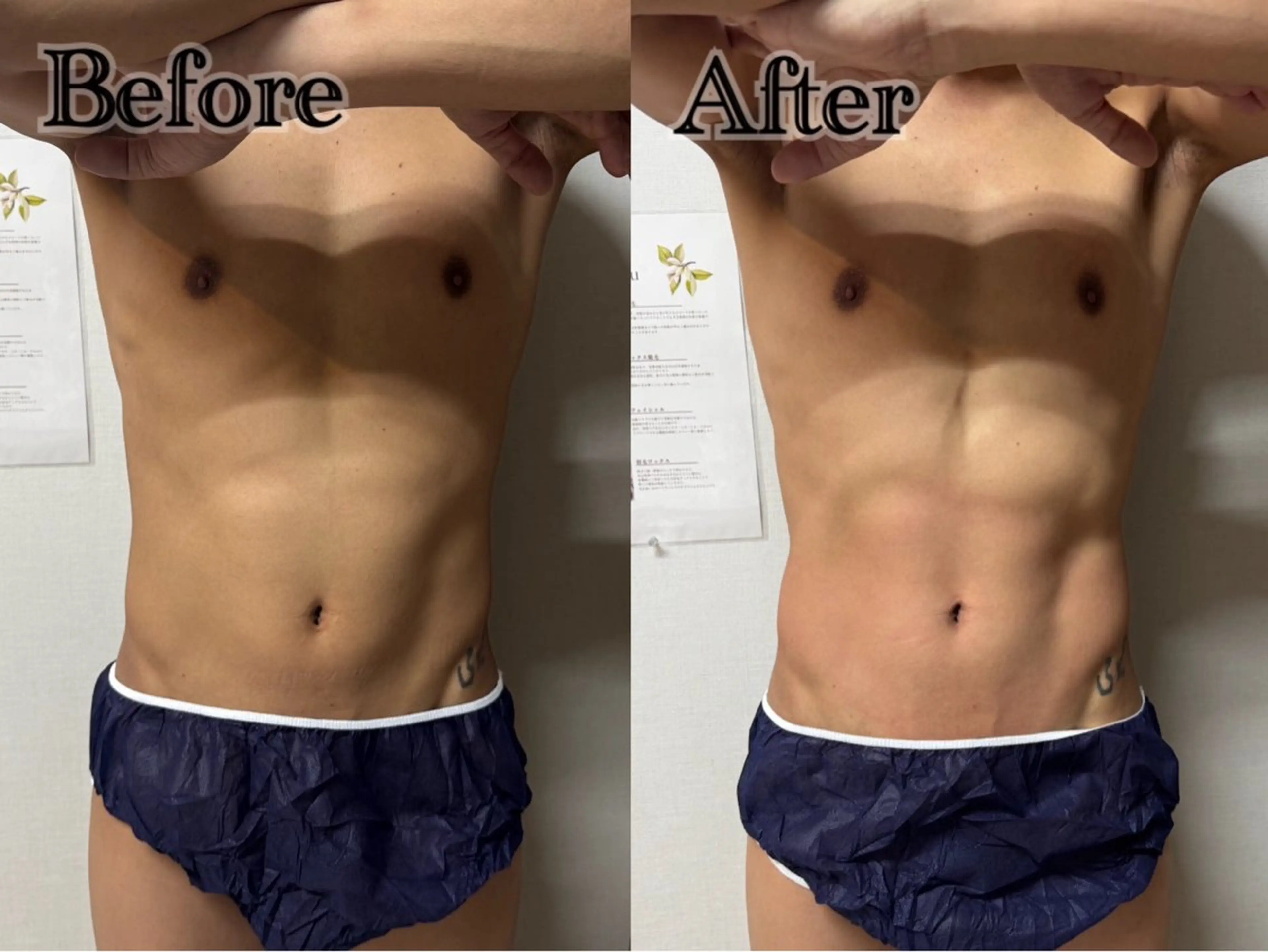 メンズ エステ 六本木/似合わせ眉毛 andＳ🍀Yuriのエステ・リラクイメージ