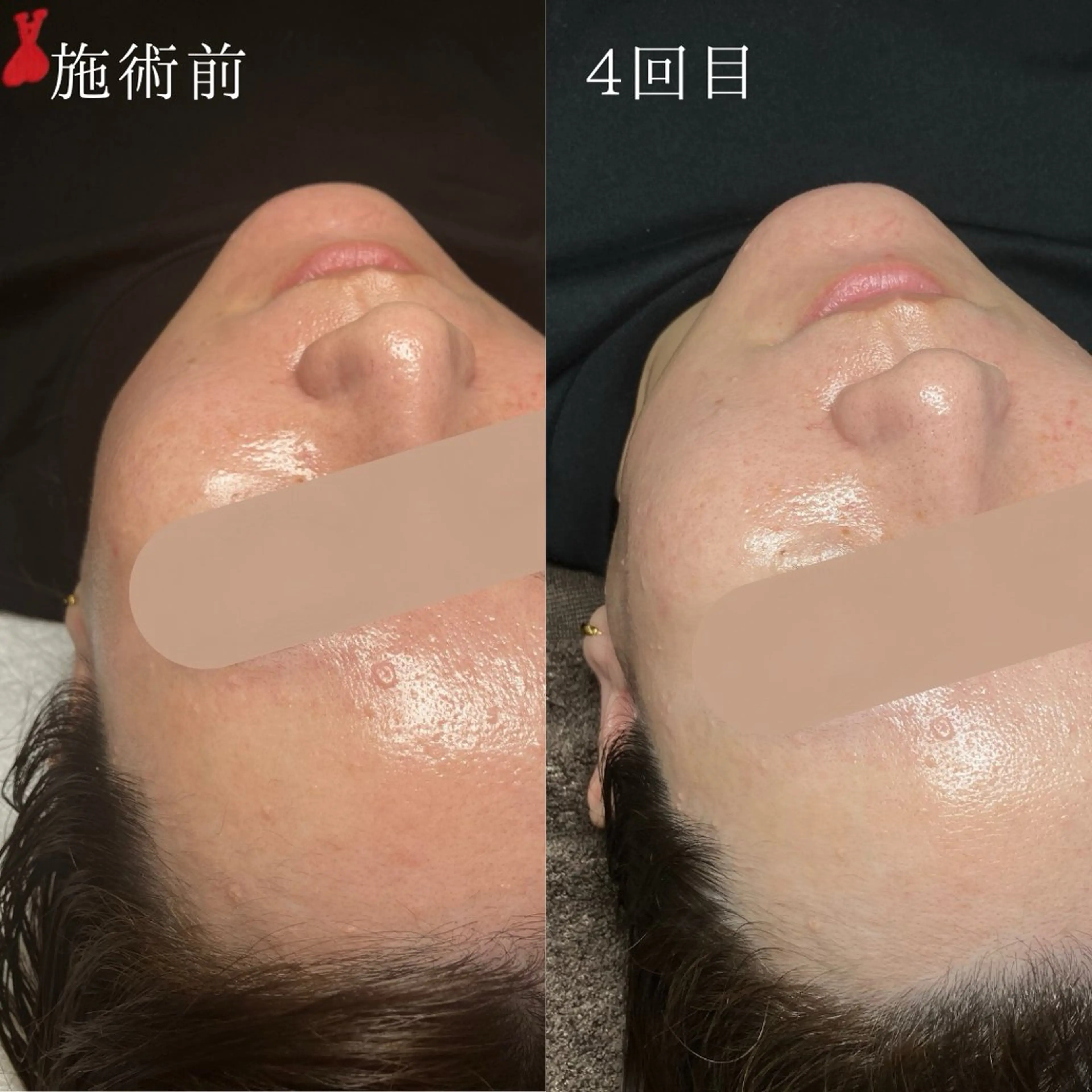 お顔を美しく魅せる 眉毛専門店ディアリーの眉毛・アイブロウイメージ