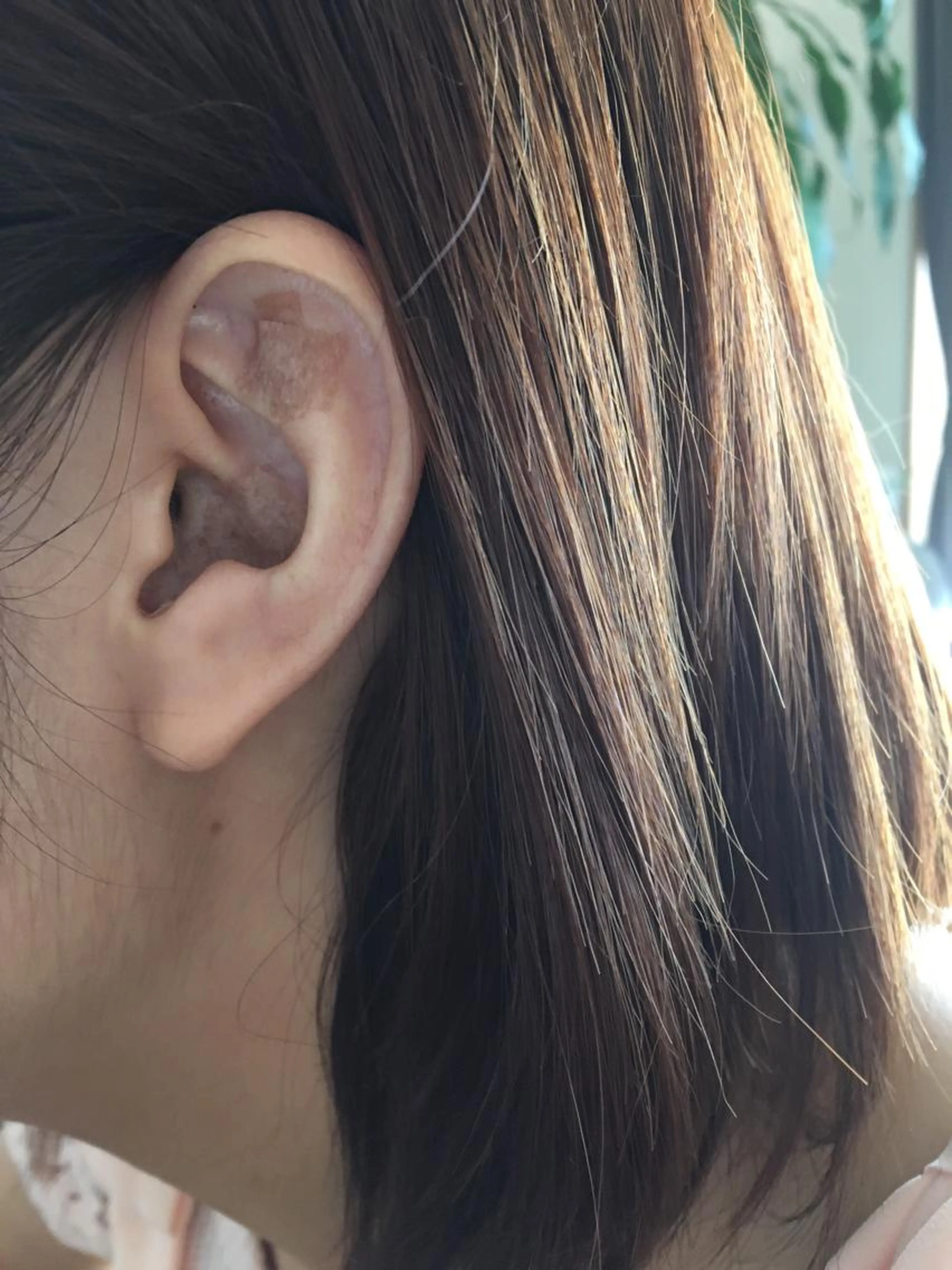 耳つぼでキレイに!の写真